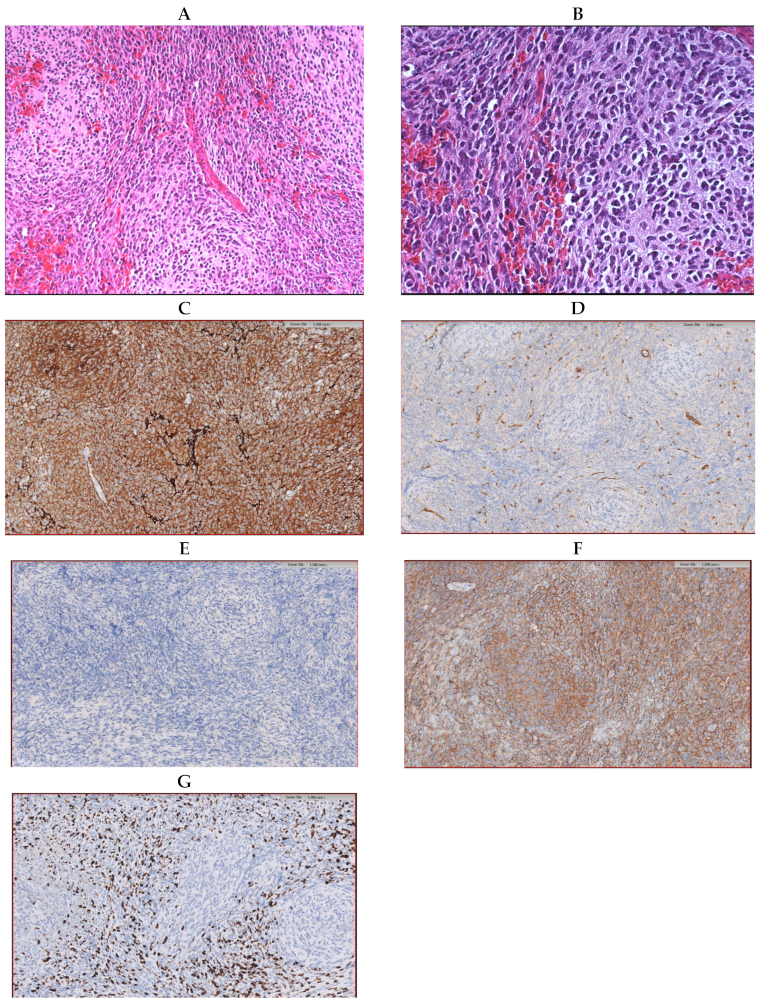 Diagnostics 11 00647 g001 Diagnostics 11 00647 g001