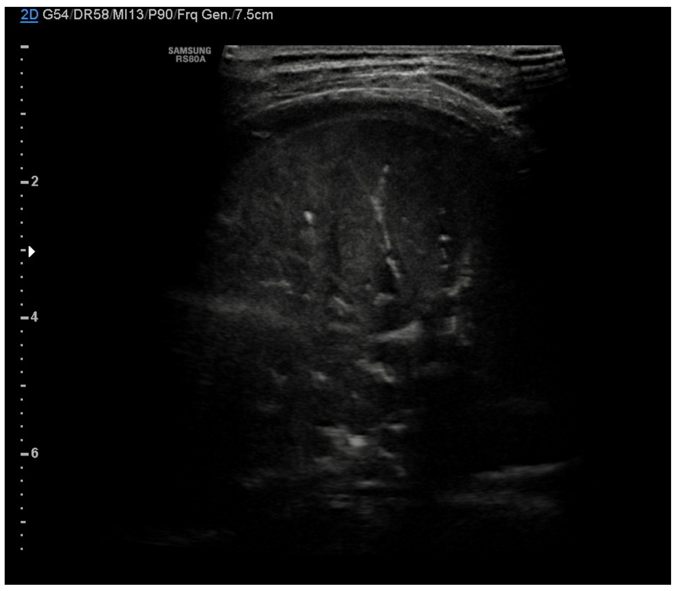 Diagnostics 11 00652 g007 Diagnostics 11 00652 g007