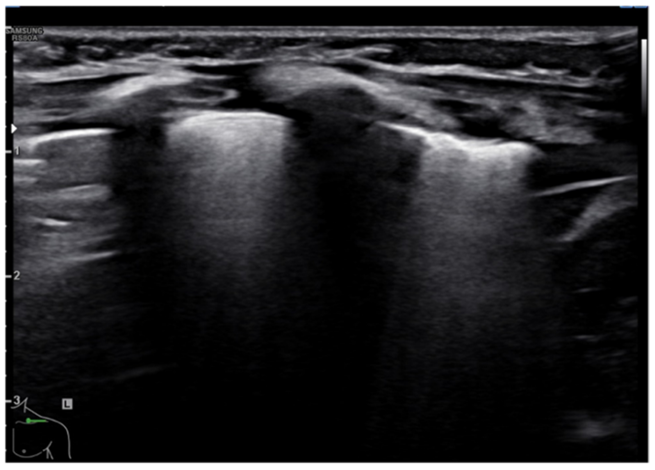 Diagnostics 11 00652 g008 Diagnostics 11 00652 g008