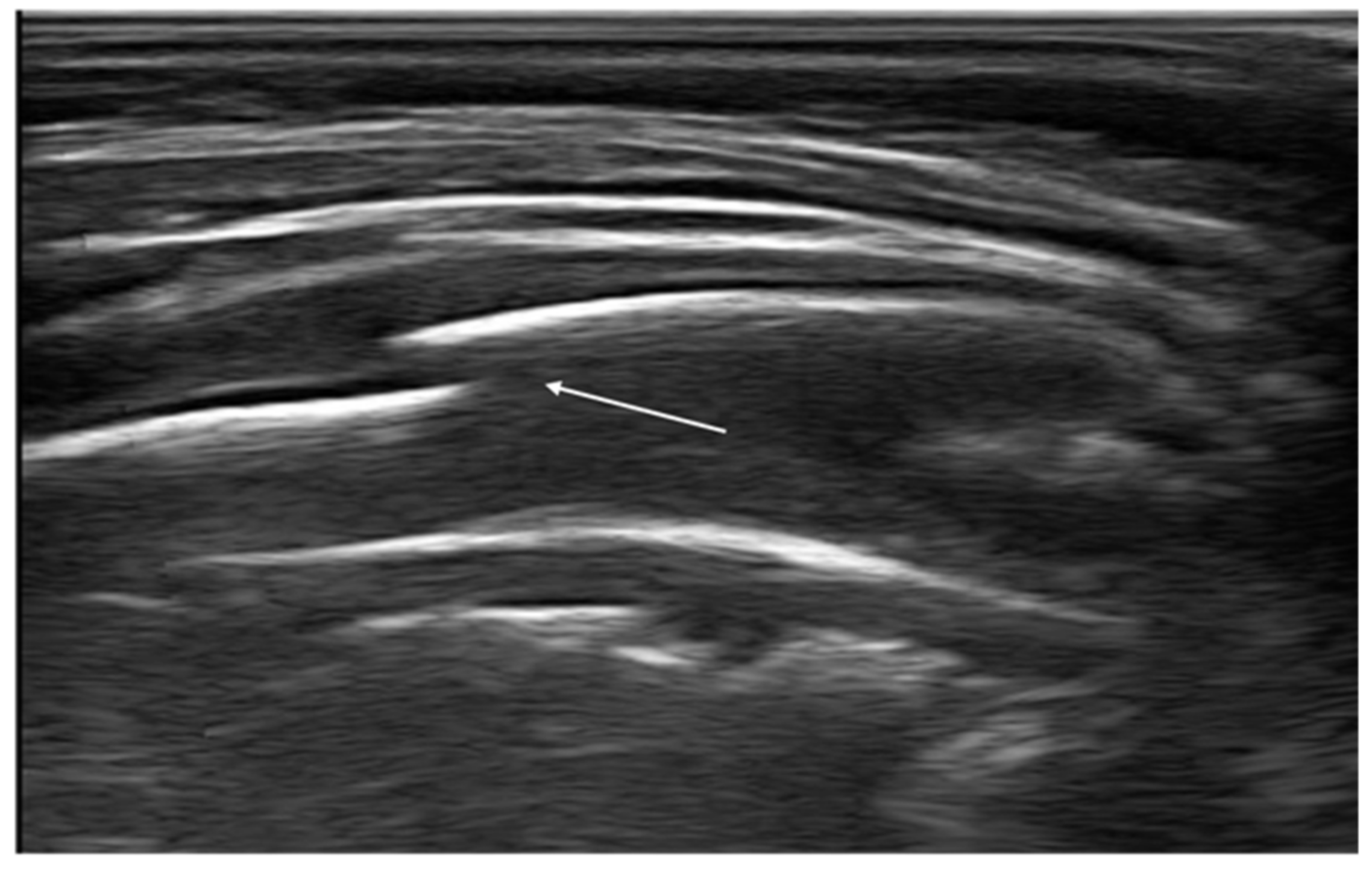 Diagnostics 11 00652 g013 Diagnostics 11 00652 g013