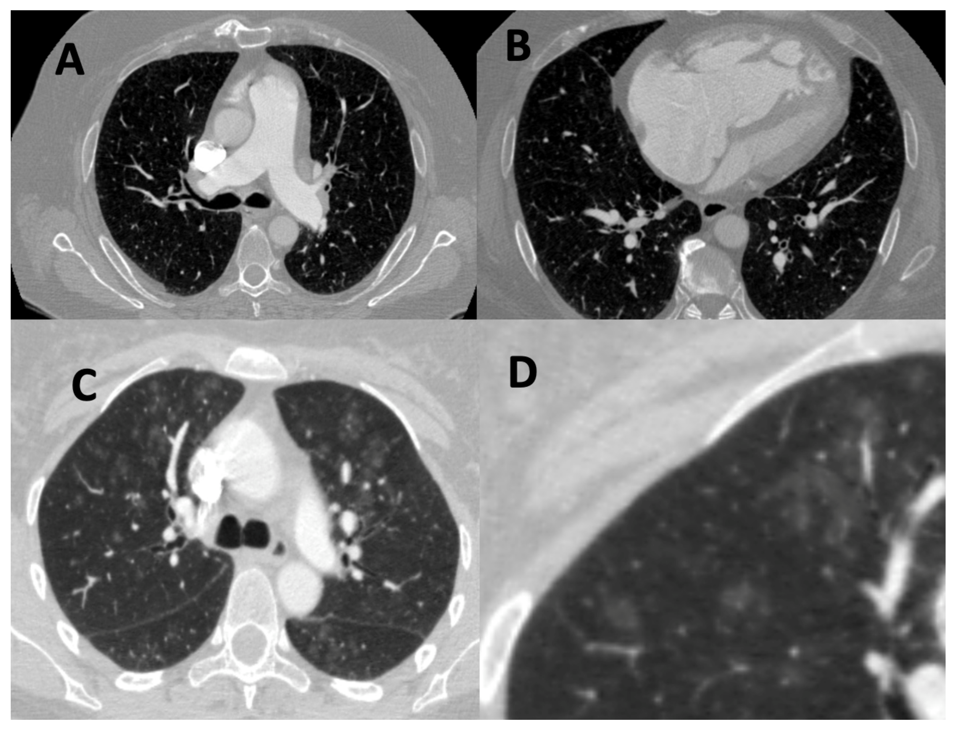 Diagnostics 11 00679 g002