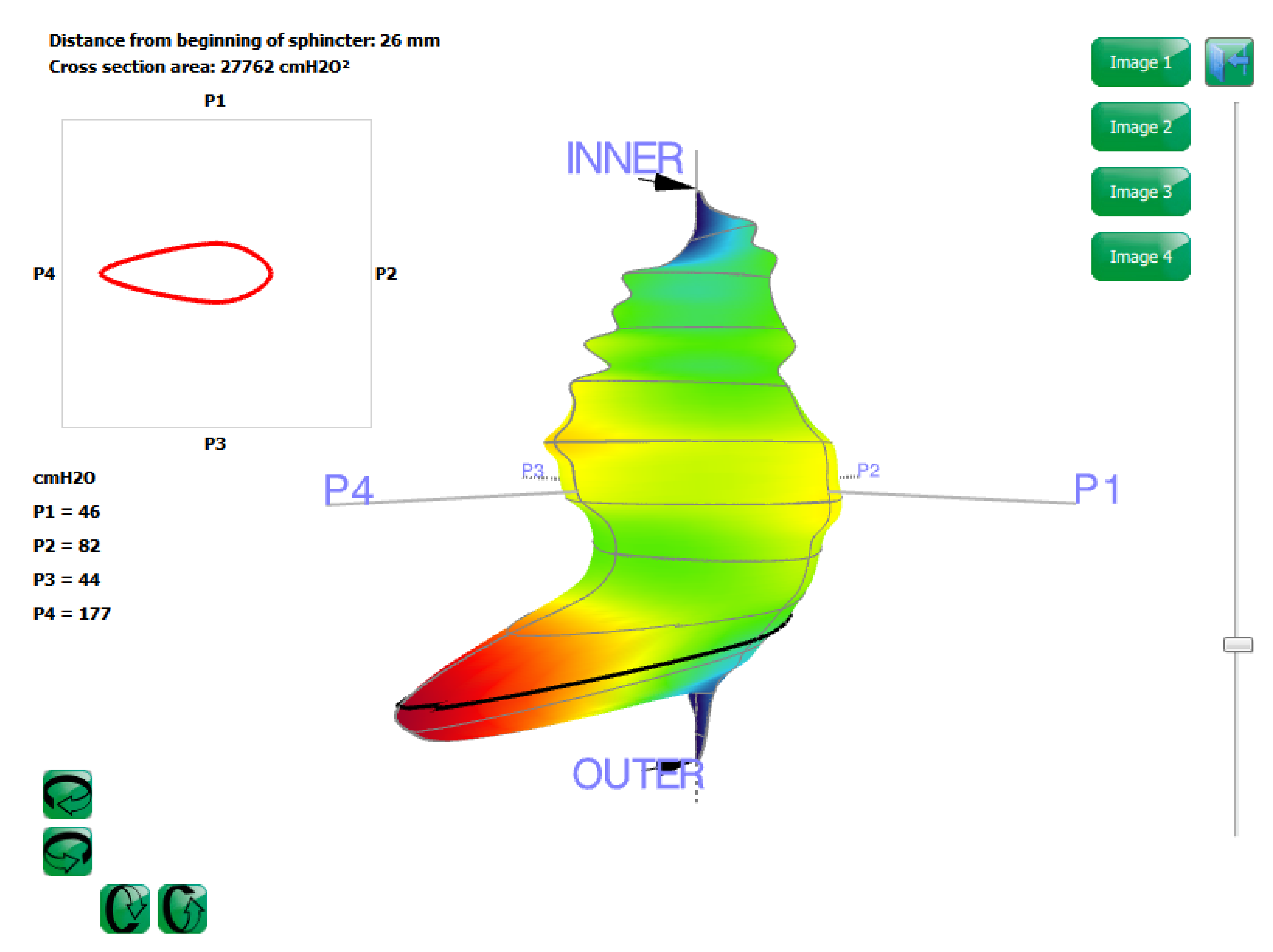 Diagnostics 11 00687 g003
