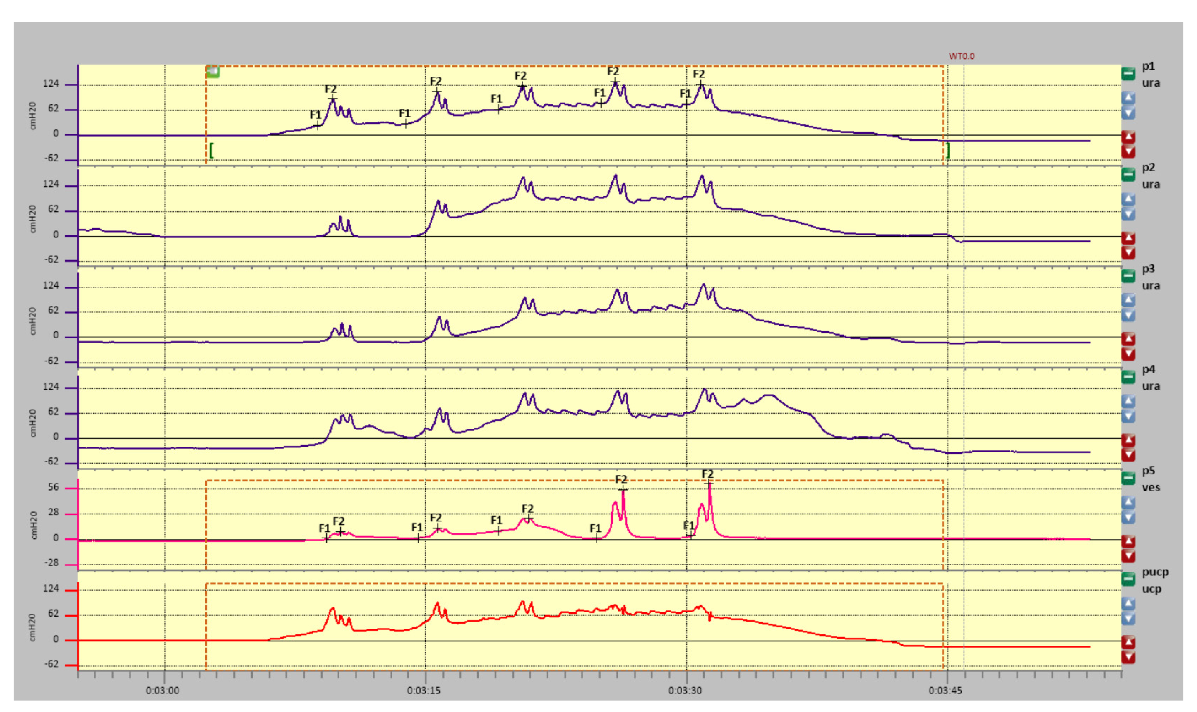 Diagnostics 11 00687 g005