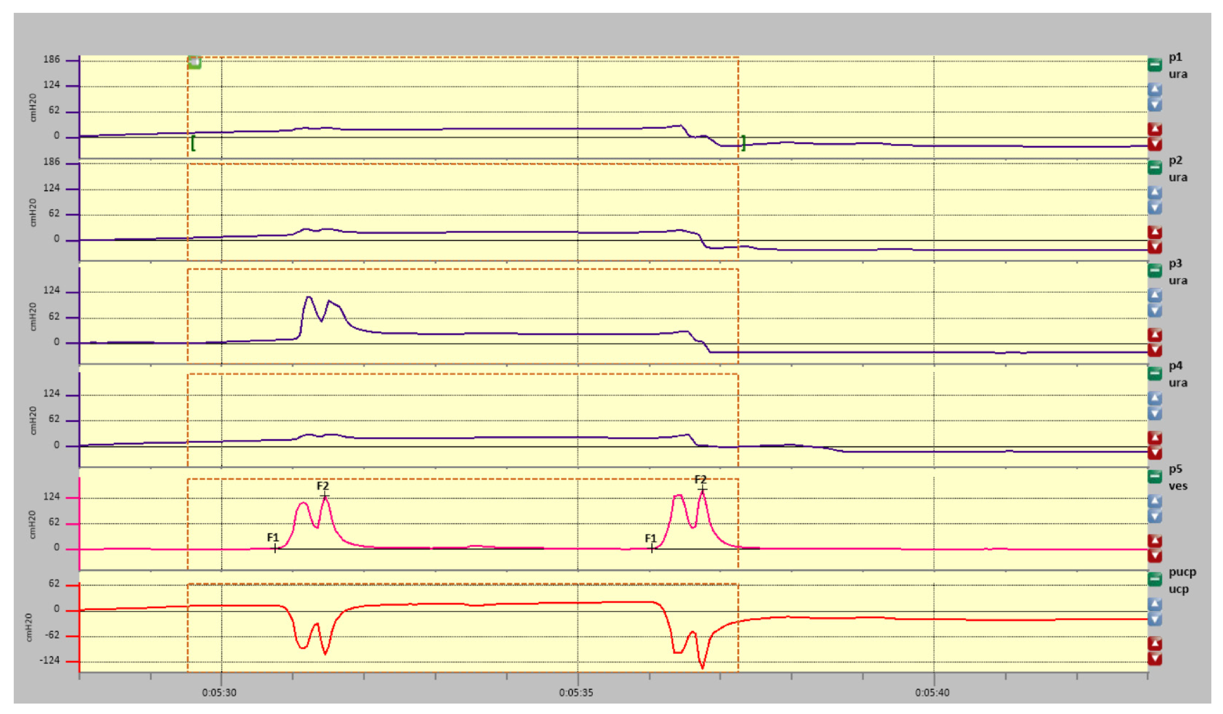Diagnostics 11 00687 g007