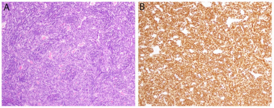 健康・医学 Diagnostic Immunohistochemistry Diagnostic Immunohistochemistry: Theranostic and Genomic