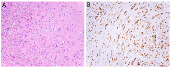 Diagnostic Immunohistochemistry of Soft Tissue and Bone
