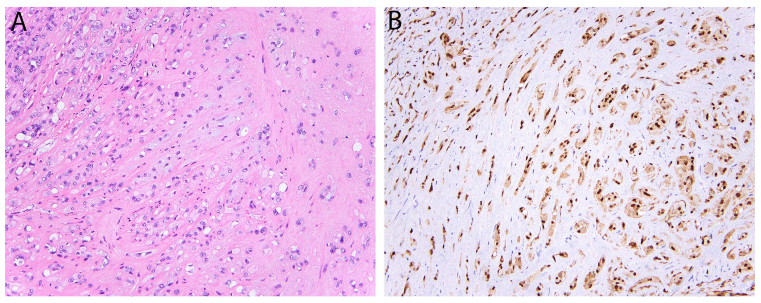 Diagnostics 11 00690 g004 Diagnostics 11 00690 g004