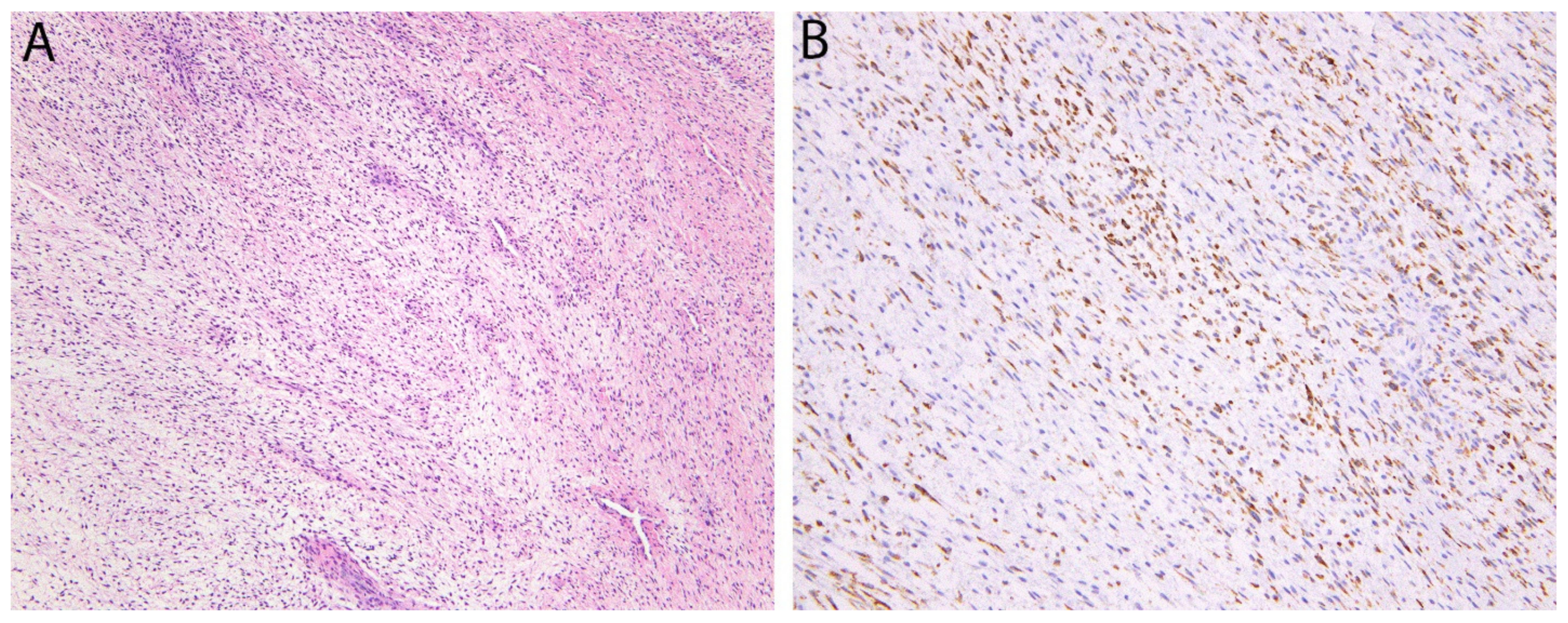 Diagnostics 11 00690 g012 Diagnostics 11 00690 g012
