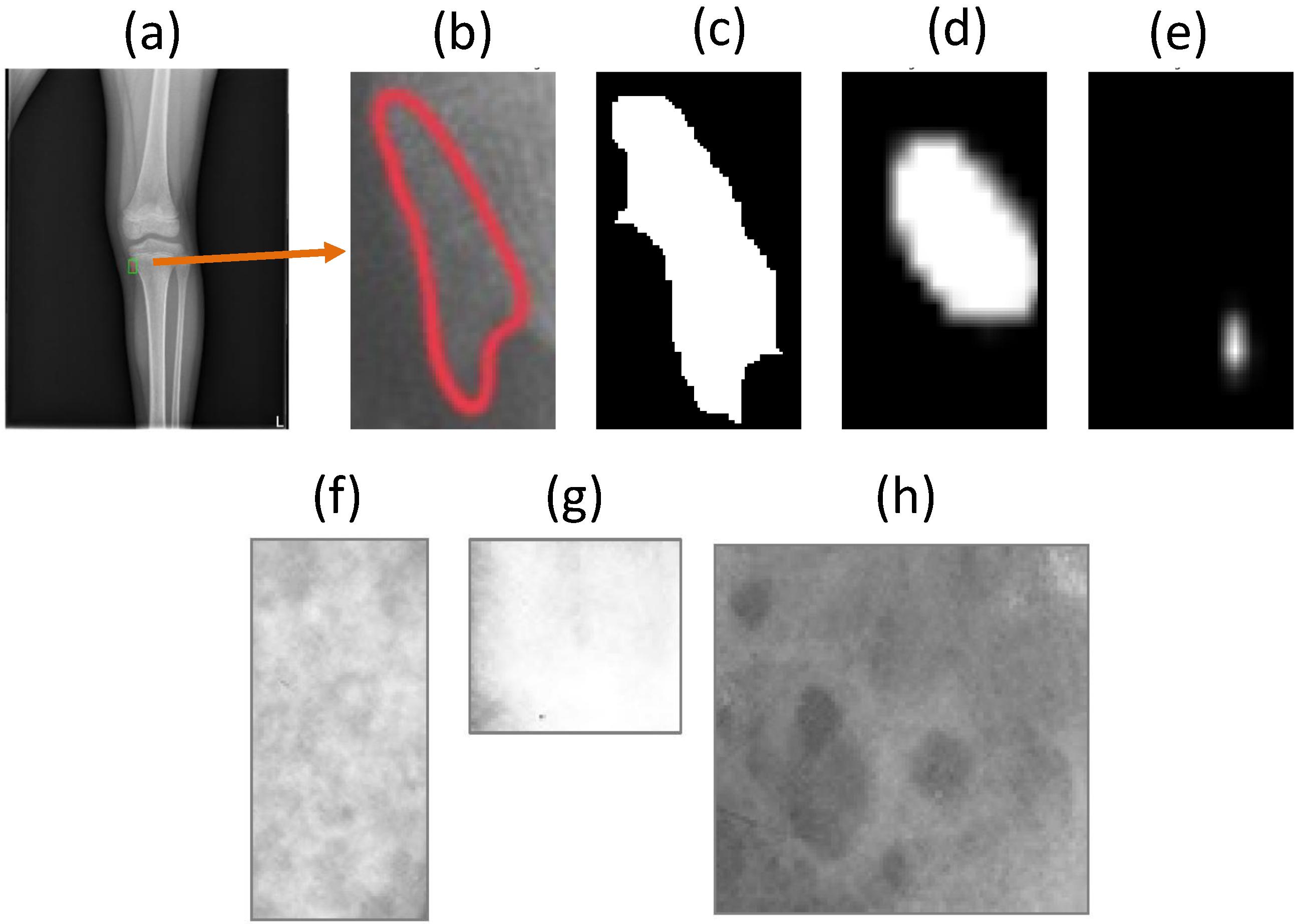Diagnostics 11 00691 g001