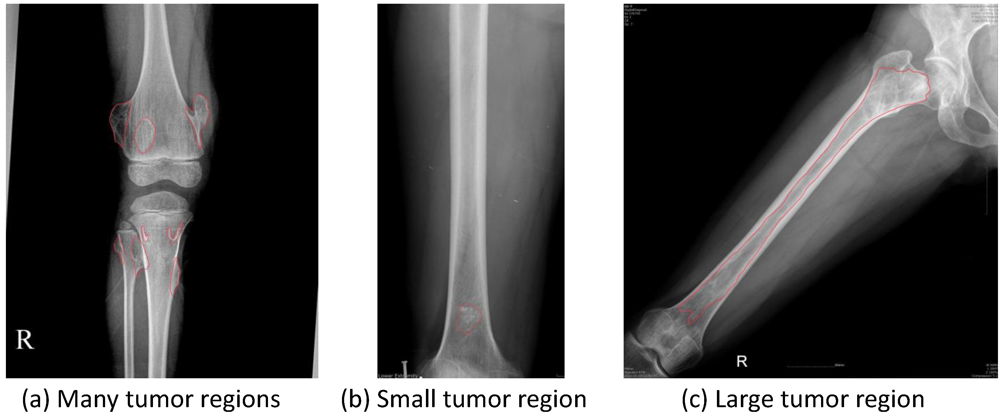 Diagnostics 11 00691 g005