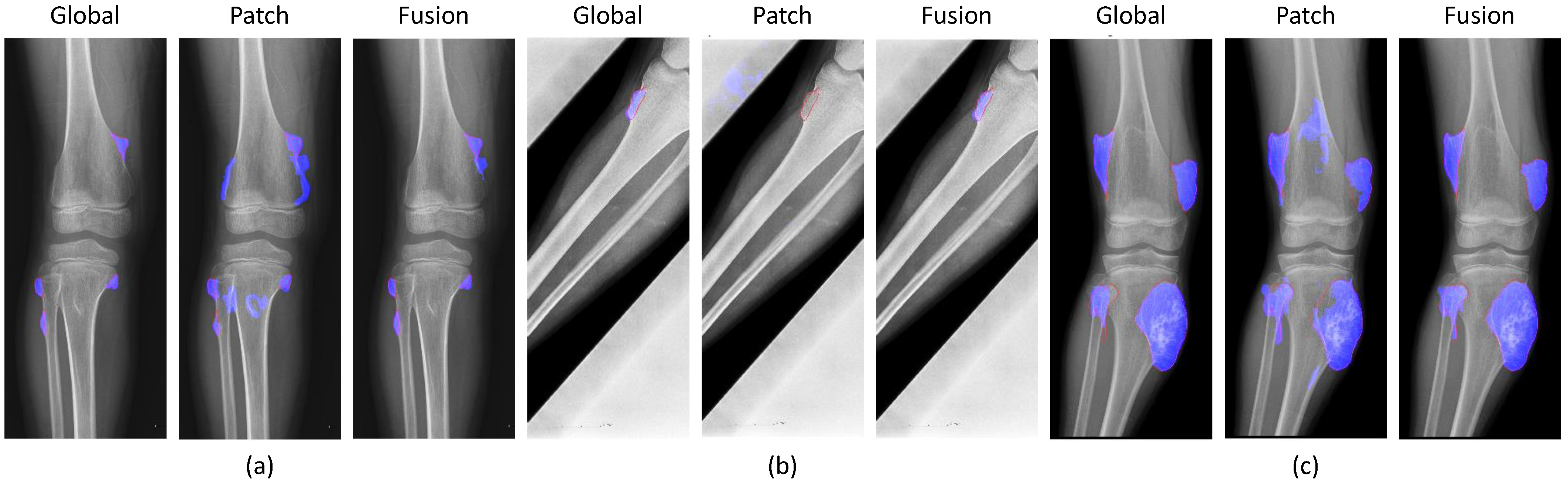 Diagnostics 11 00691 g011
