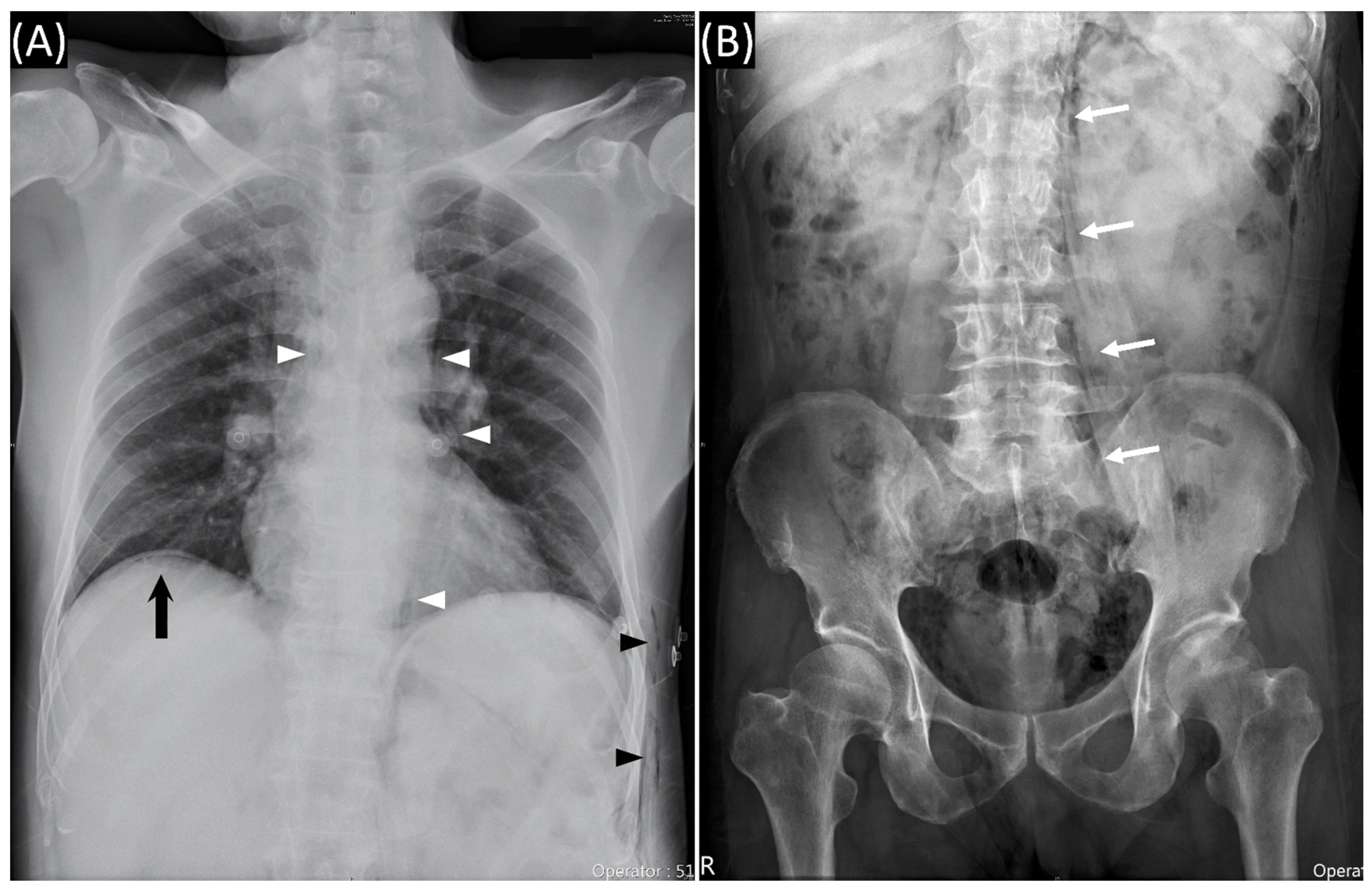 Diagnostics 11 00707 g002