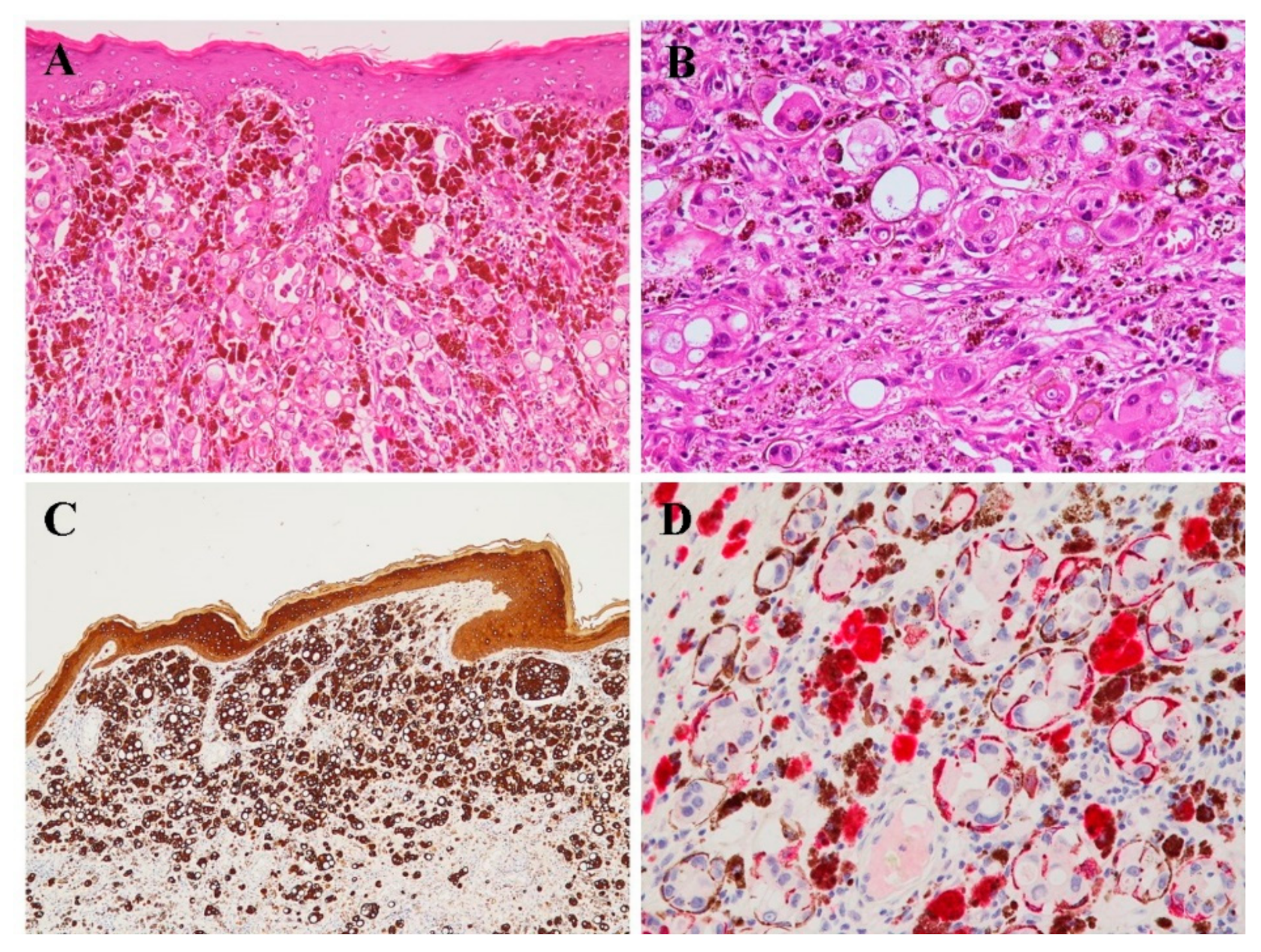 Diagnostics 11 00709 g002