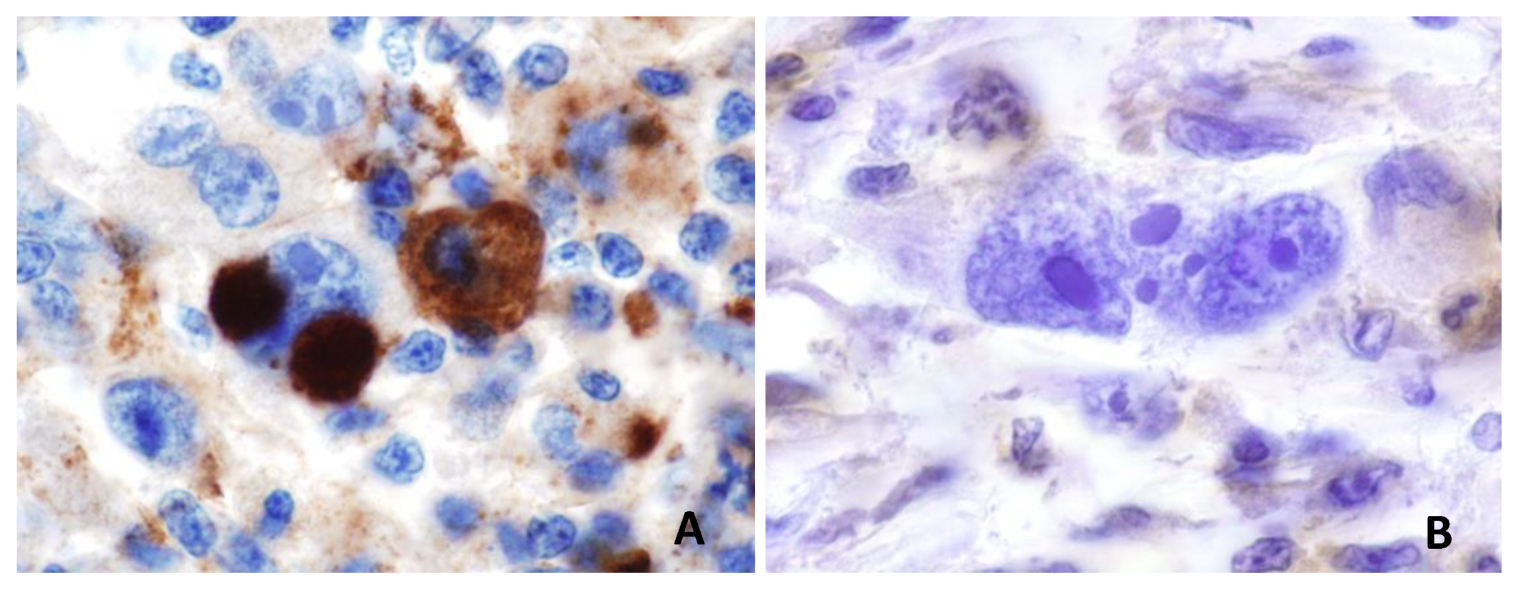 Diagnostics 11 00710 g002 Diagnostics 11 00710 g002