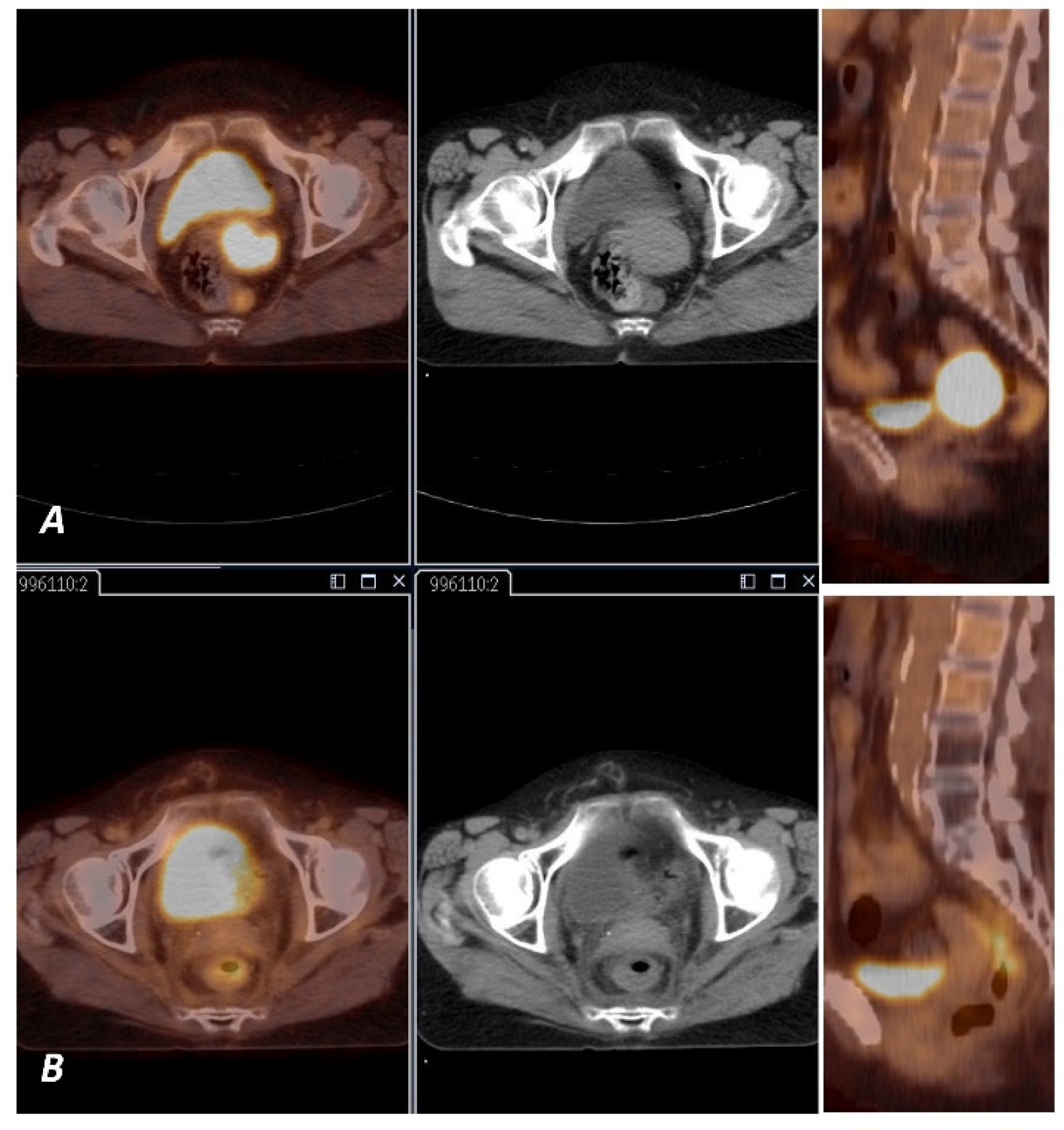 Diagnostics 11 00714 g003