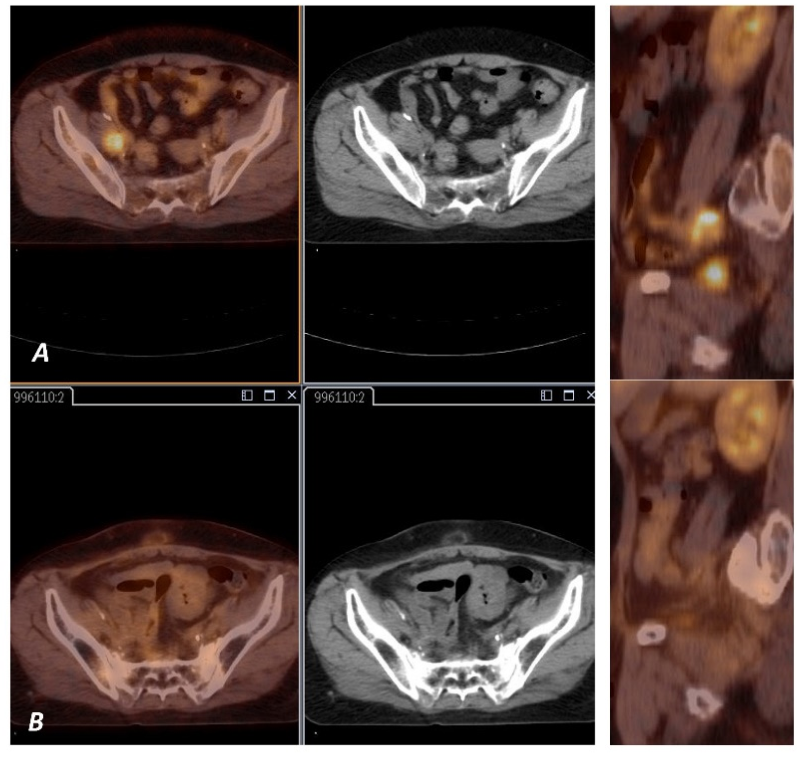 Diagnostics 11 00714 g004