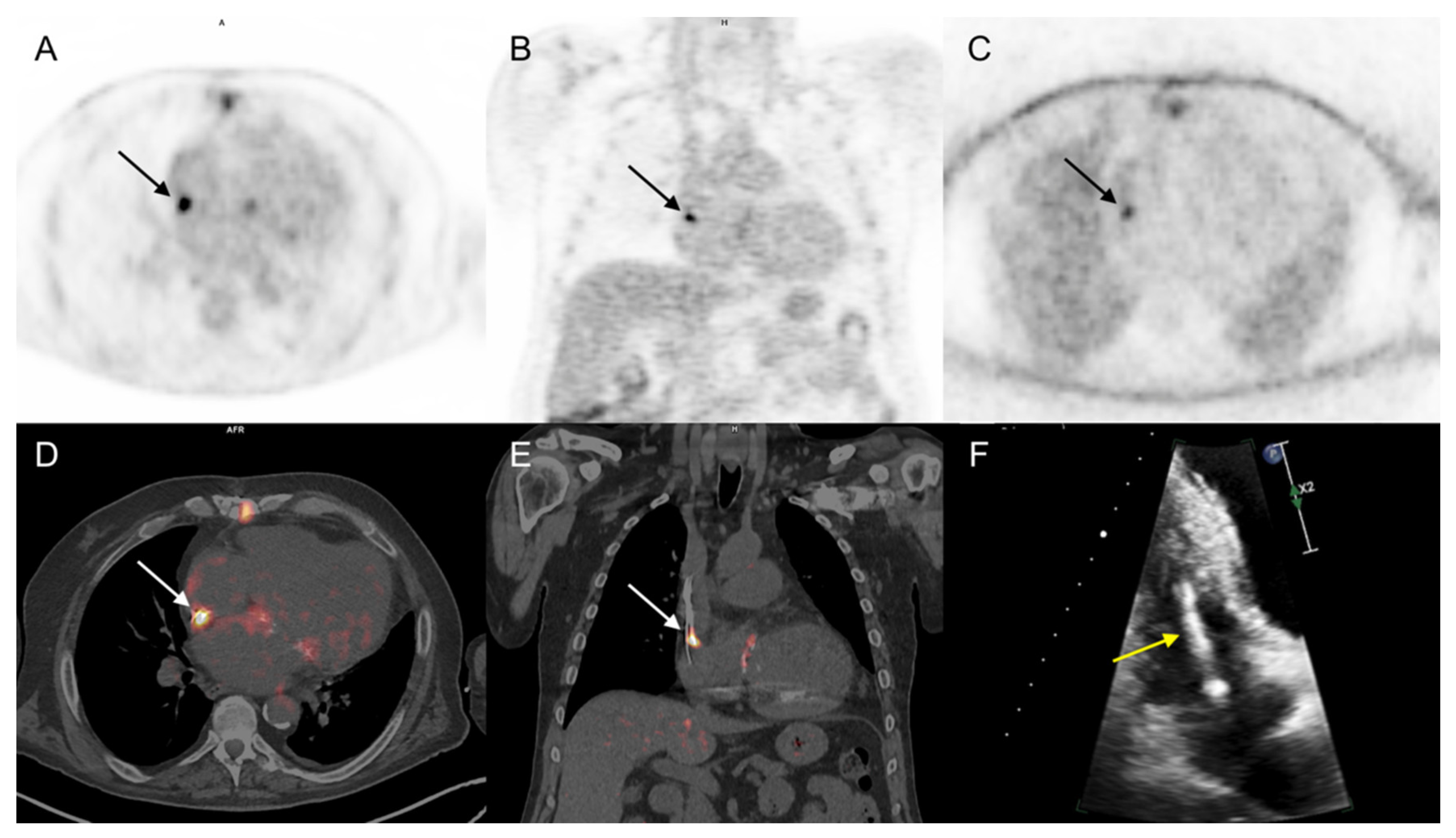 Diagnostics 11 00720 g003