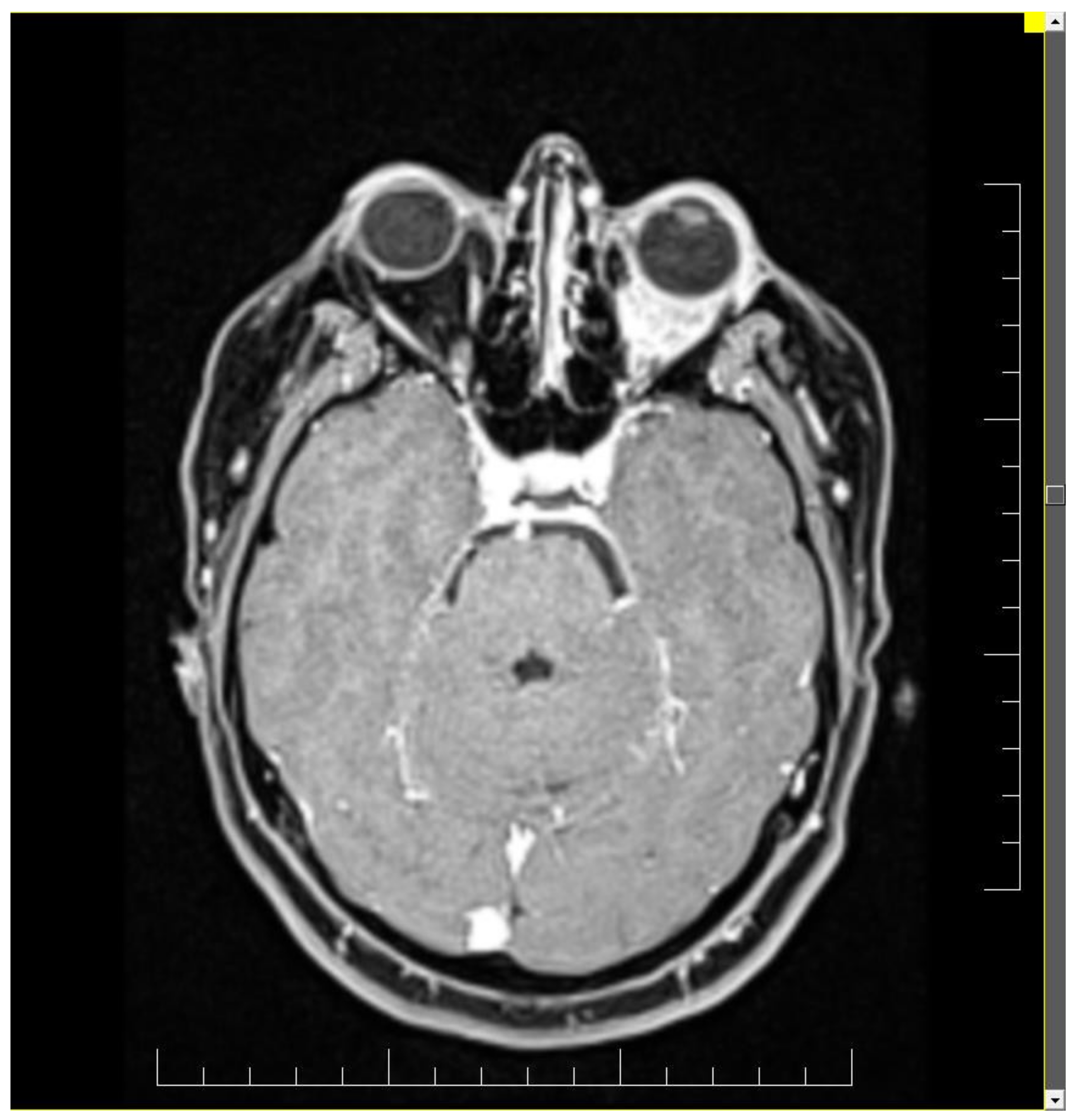 Diagnostics 11 00725 g001