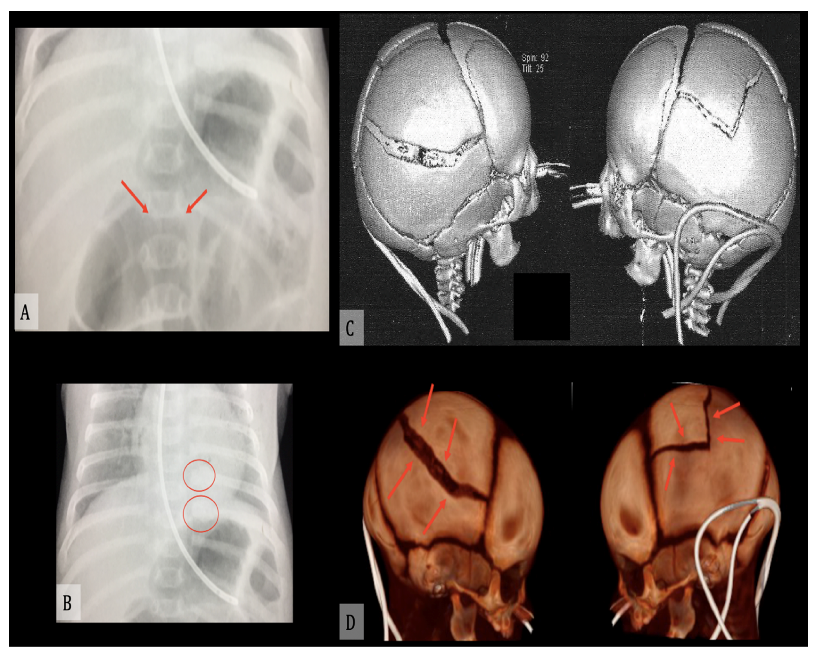 Diagnostics 11 00734 g003 Diagnostics 11 00734 g003