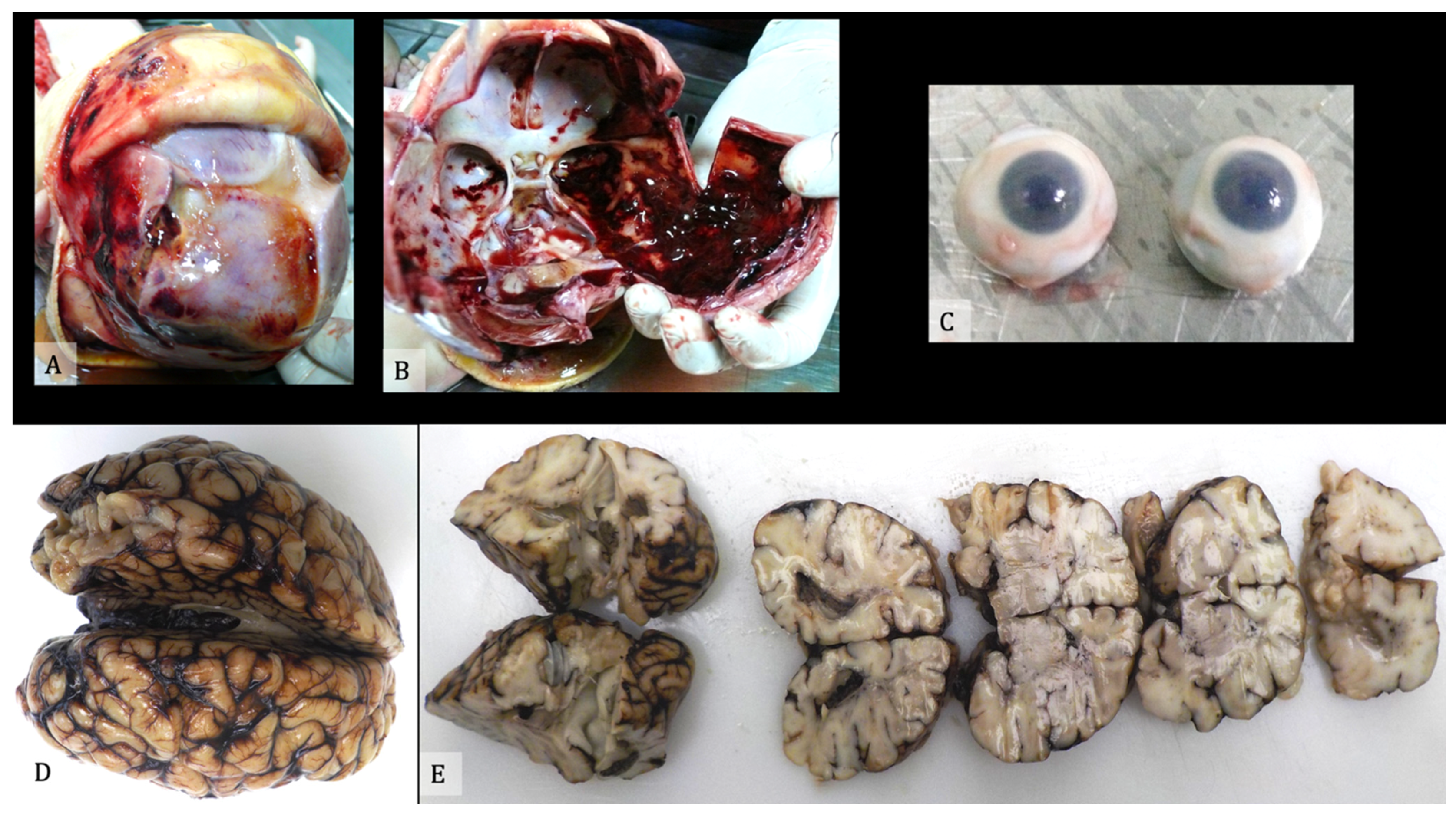 Diagnostics 11 00734 g004 Diagnostics 11 00734 g004