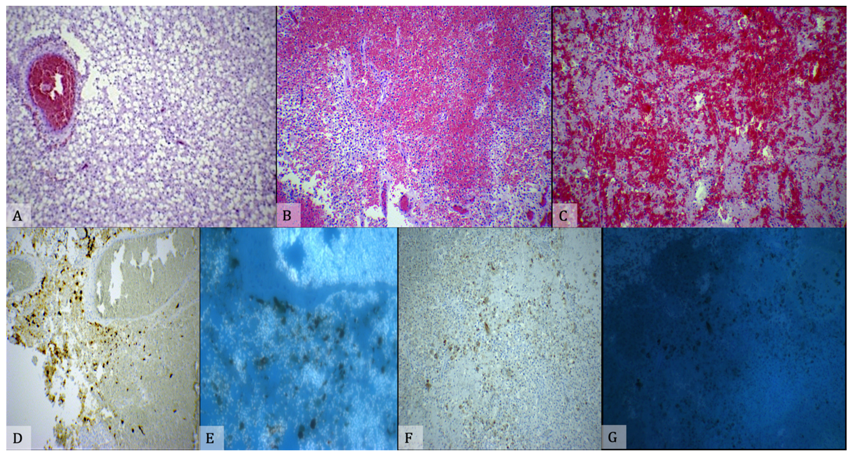 Diagnostics 11 00734 g005 Diagnostics 11 00734 g005