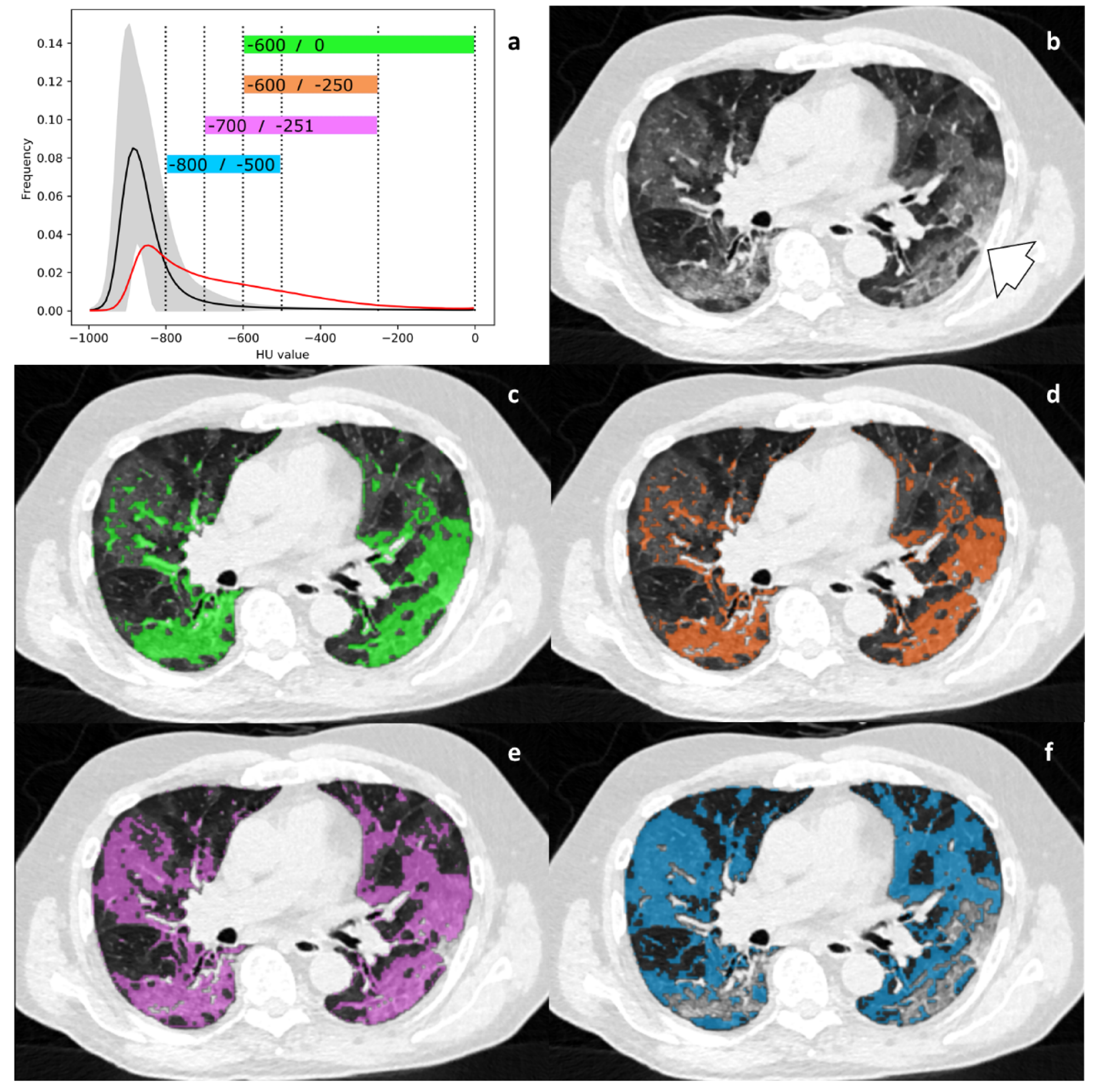 Diagnostics 11 00738 g003 Diagnostics 11 00738 g003