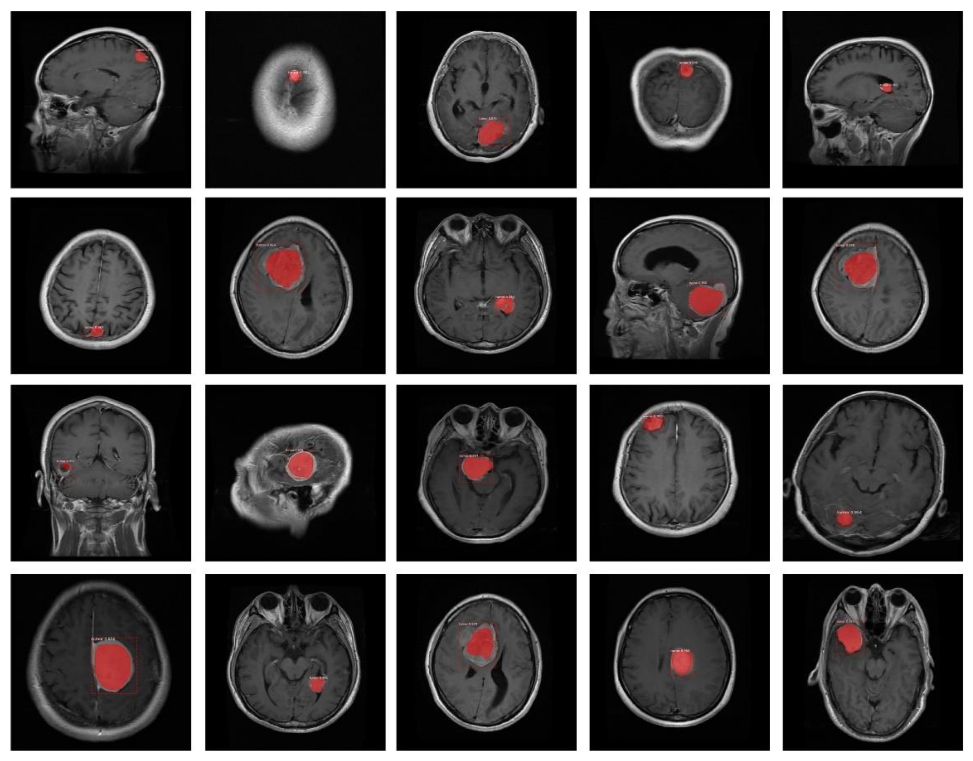 Diagnostics 11 00744 g008 Diagnostics 11 00744 g008