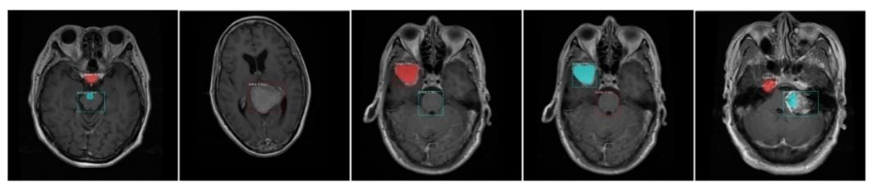 Diagnostics 11 00744 g010 Diagnostics 11 00744 g010