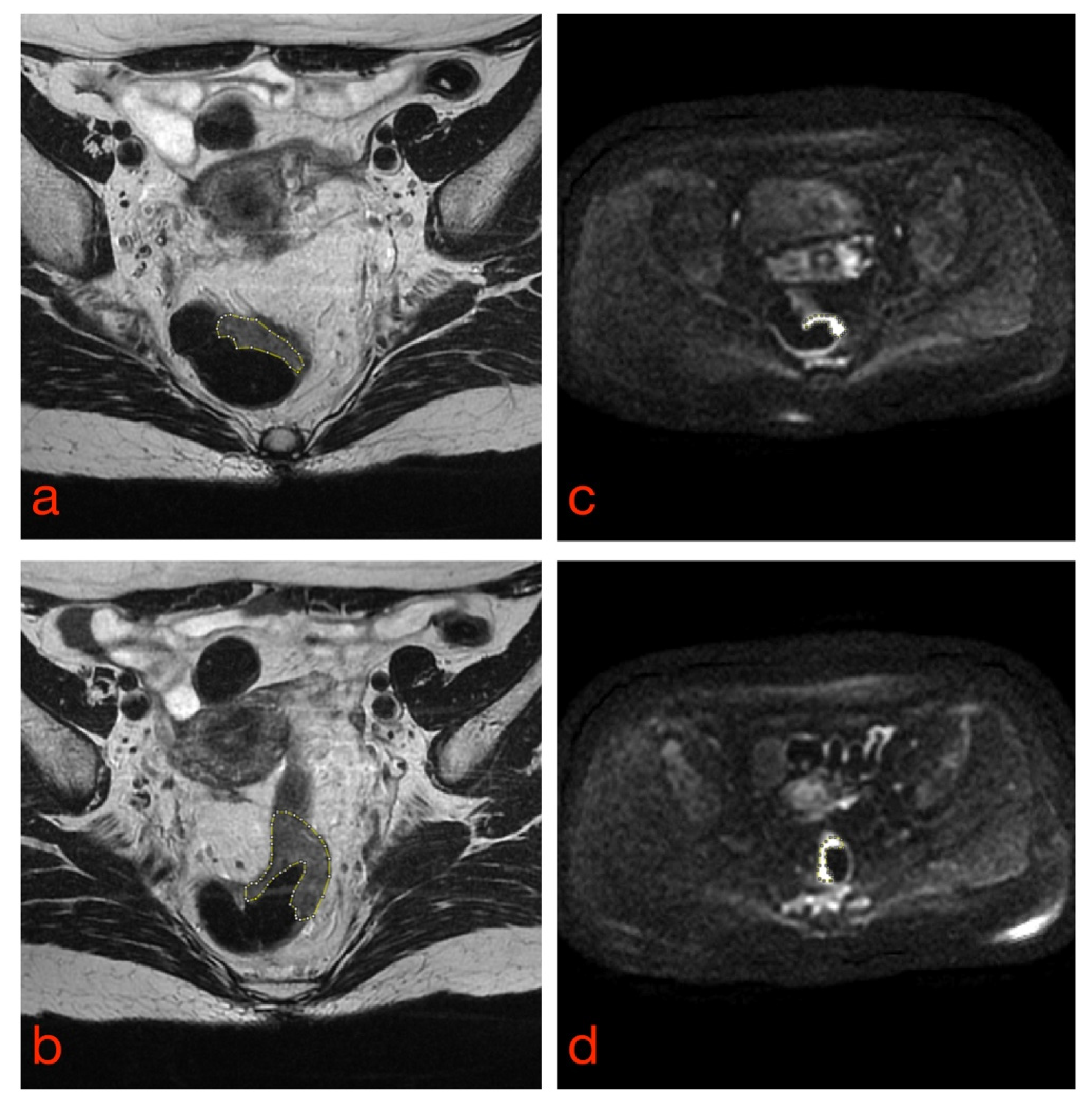 Diagnostics 11 00756 g002
