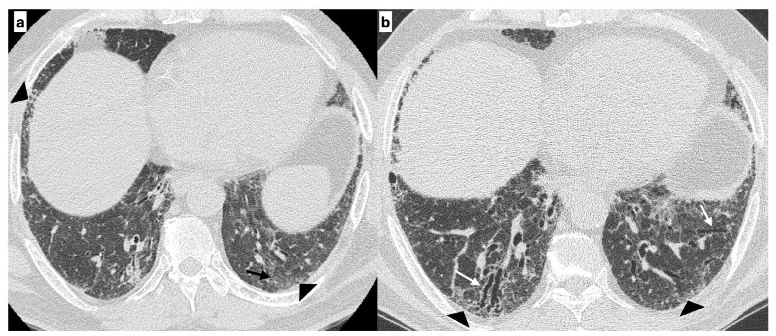 Diagnostics 11 00762 g005