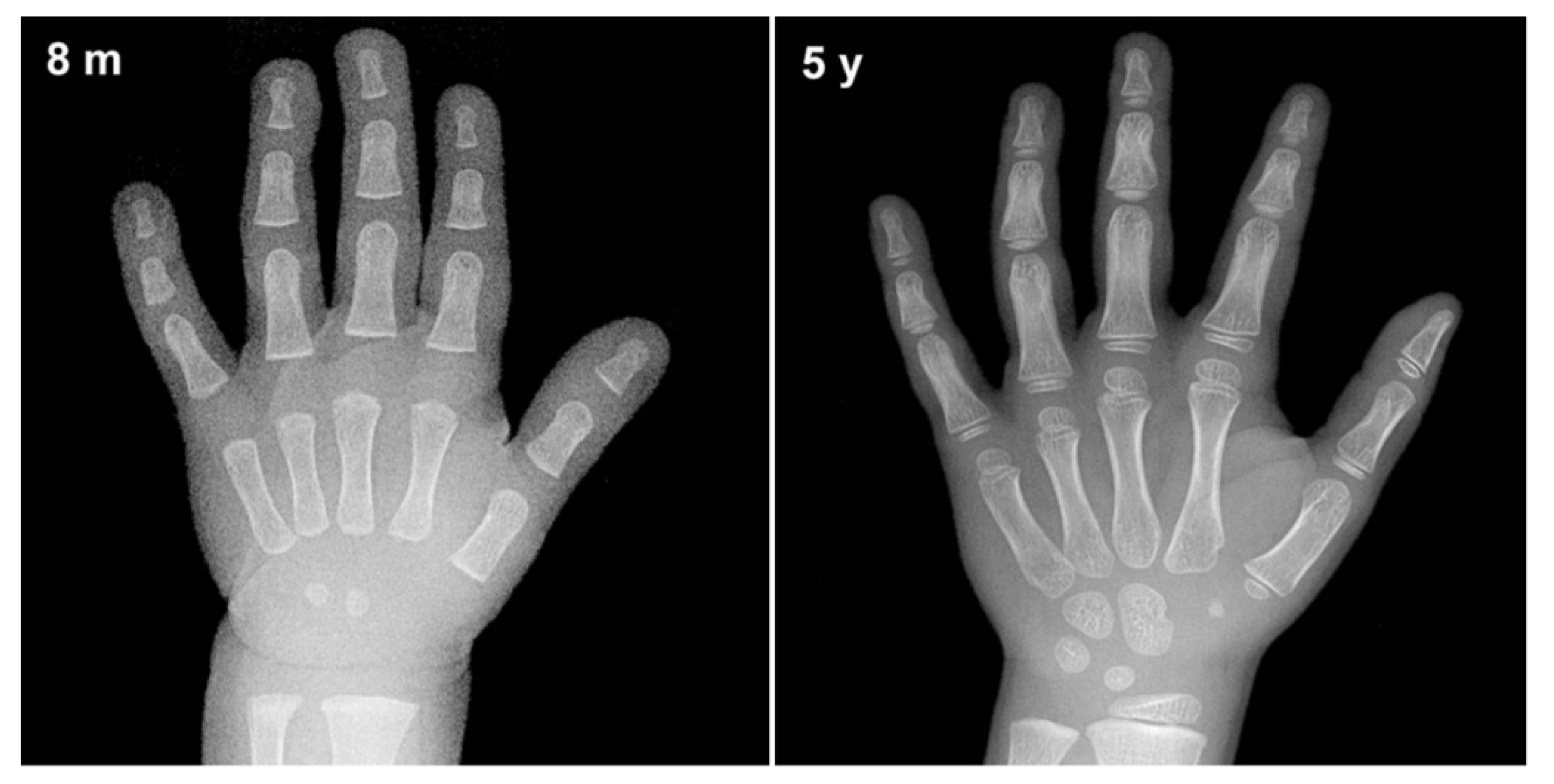 Diagnostics Free FullText Intelligent Bone Age Assessment An