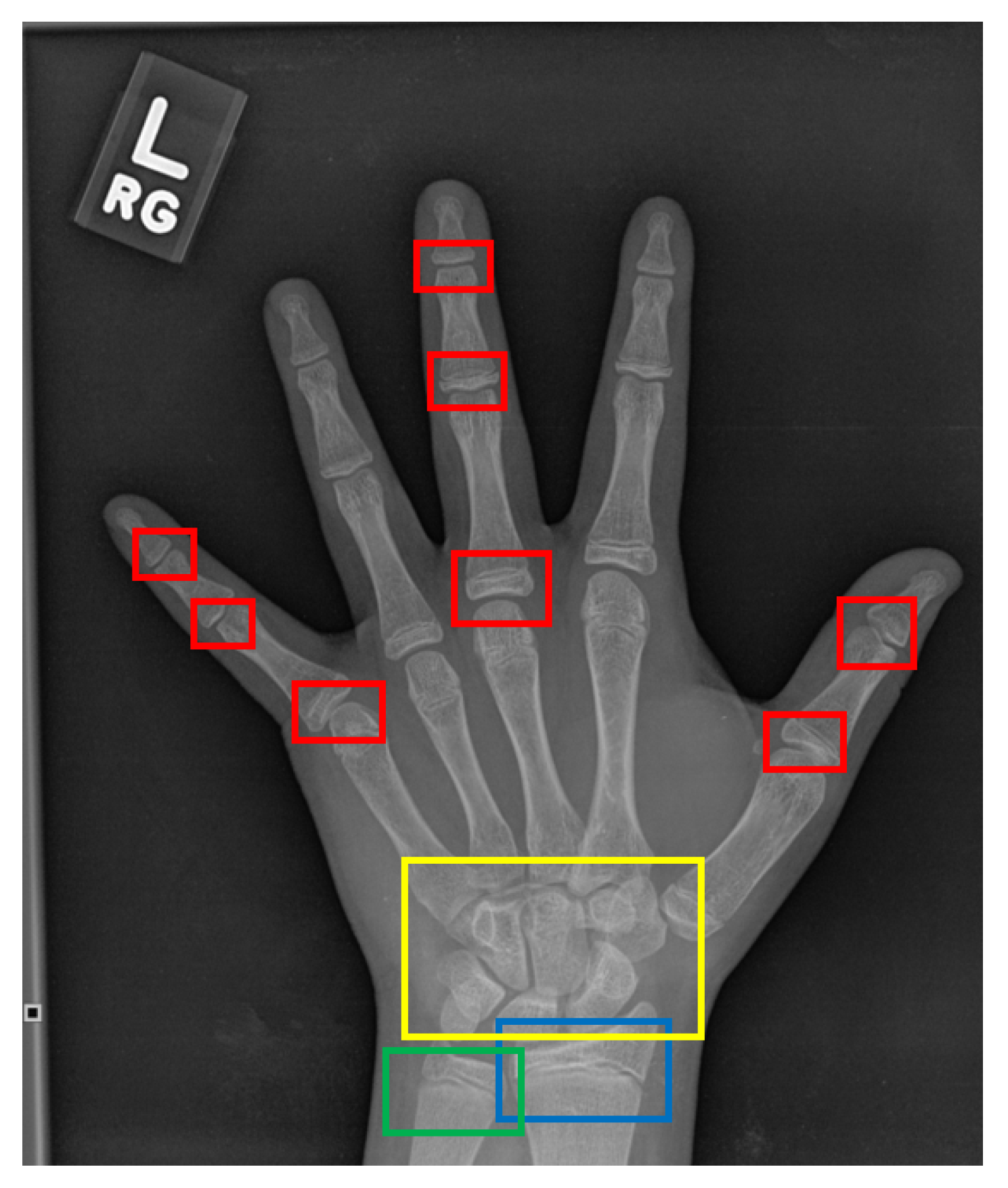 Diagnostics 11 00765 g002 Diagnostics 11 00765 g002