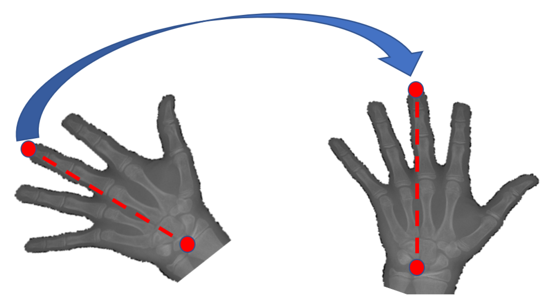 Diagnostics 11 00765 g004 Diagnostics 11 00765 g004