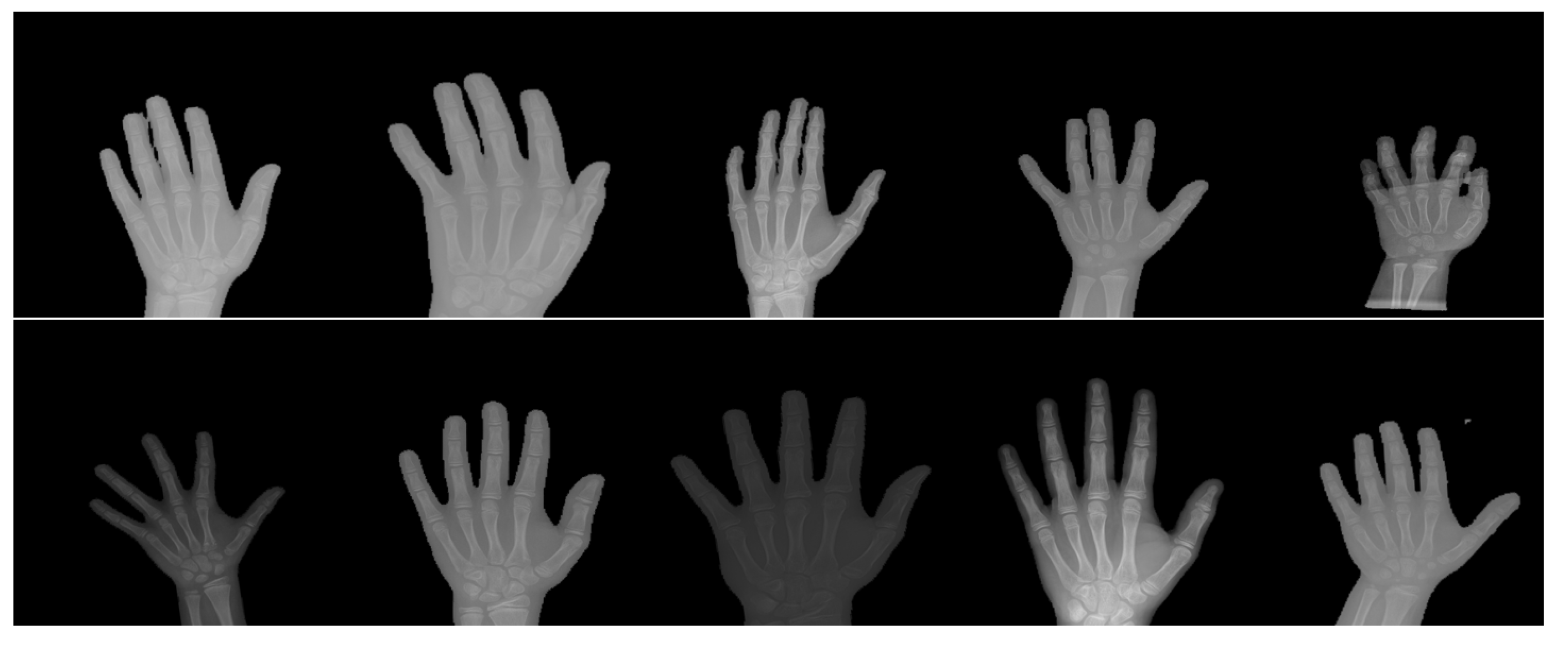 Diagnostics 11 00765 g008 Diagnostics 11 00765 g008