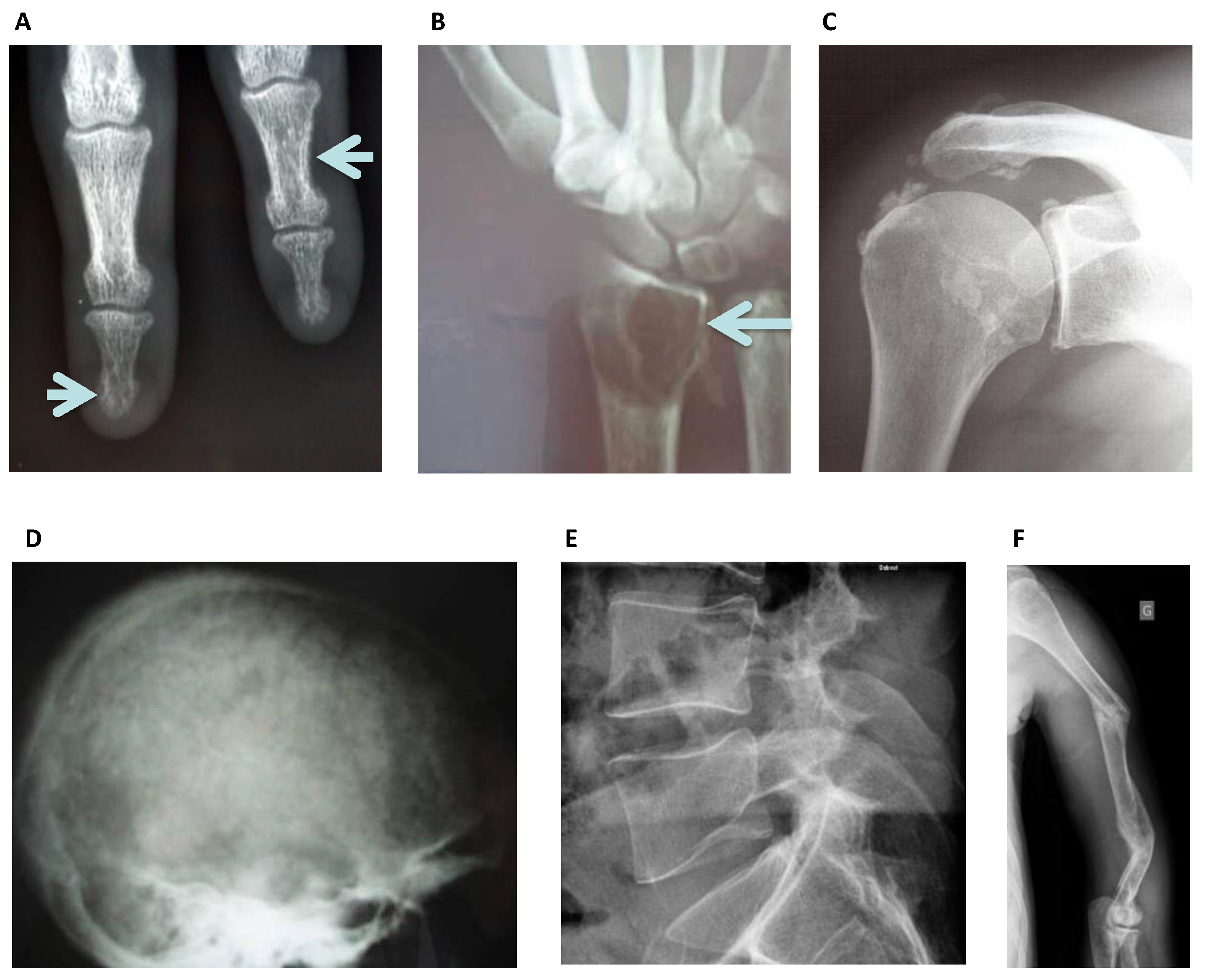 Diagnostics 11 00772 g003 Diagnostics 11 00772 g003