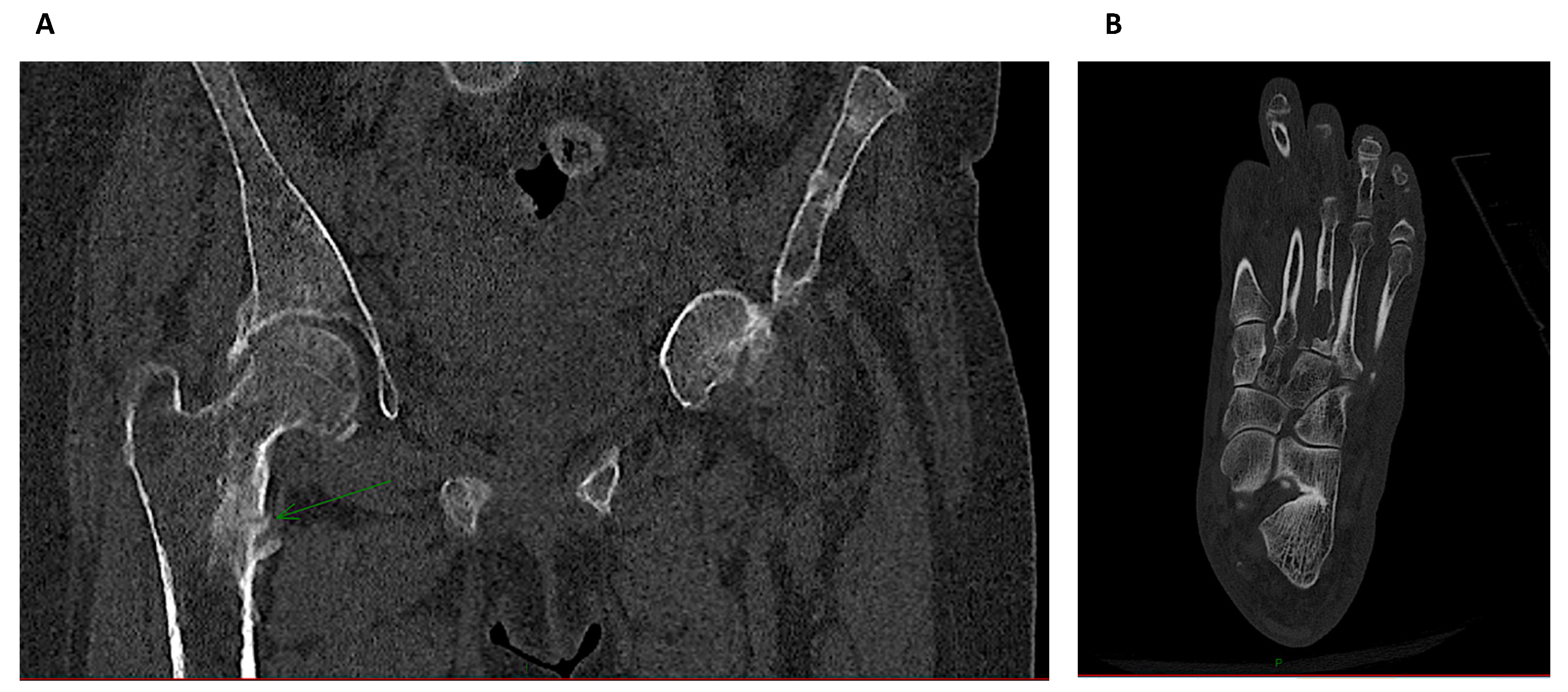 Diagnostics 11 00772 g004 Diagnostics 11 00772 g004
