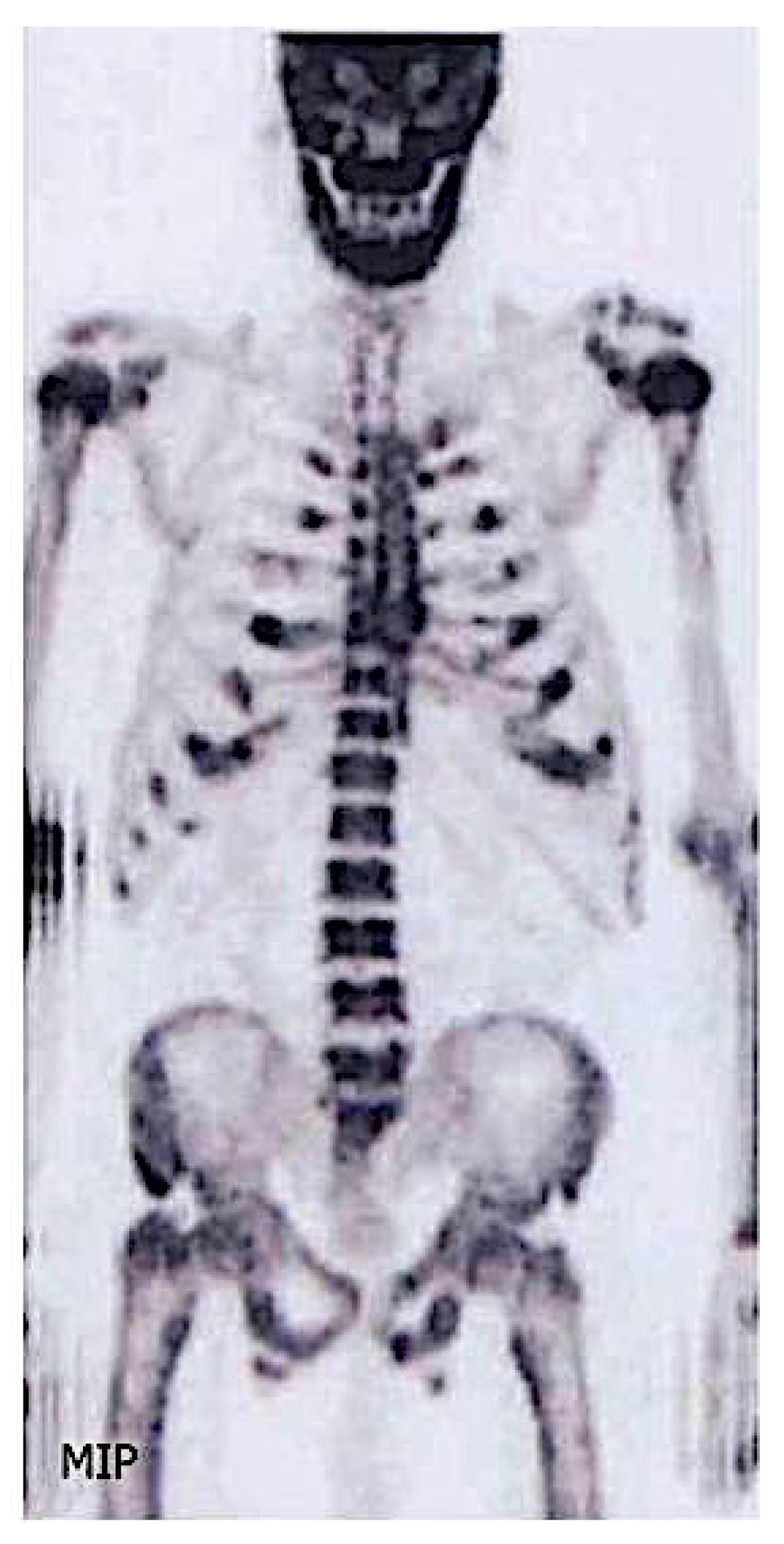 Diagnostics 11 00772 g007 Diagnostics 11 00772 g007