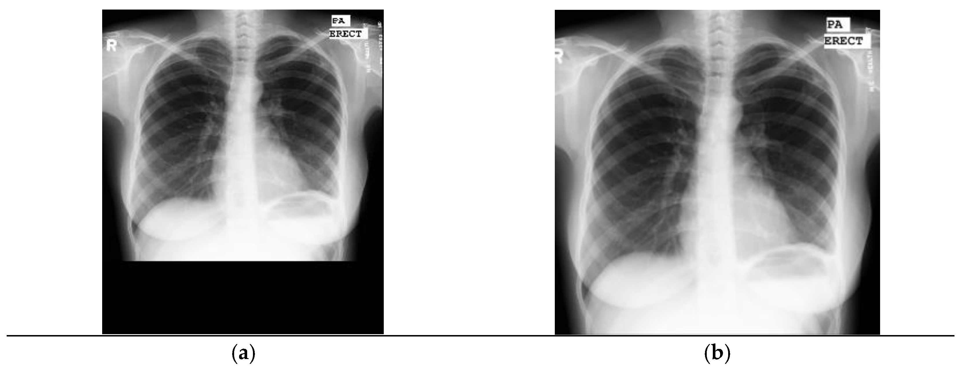 Diagnostics 11 00775 g004 Diagnostics 11 00775 g004