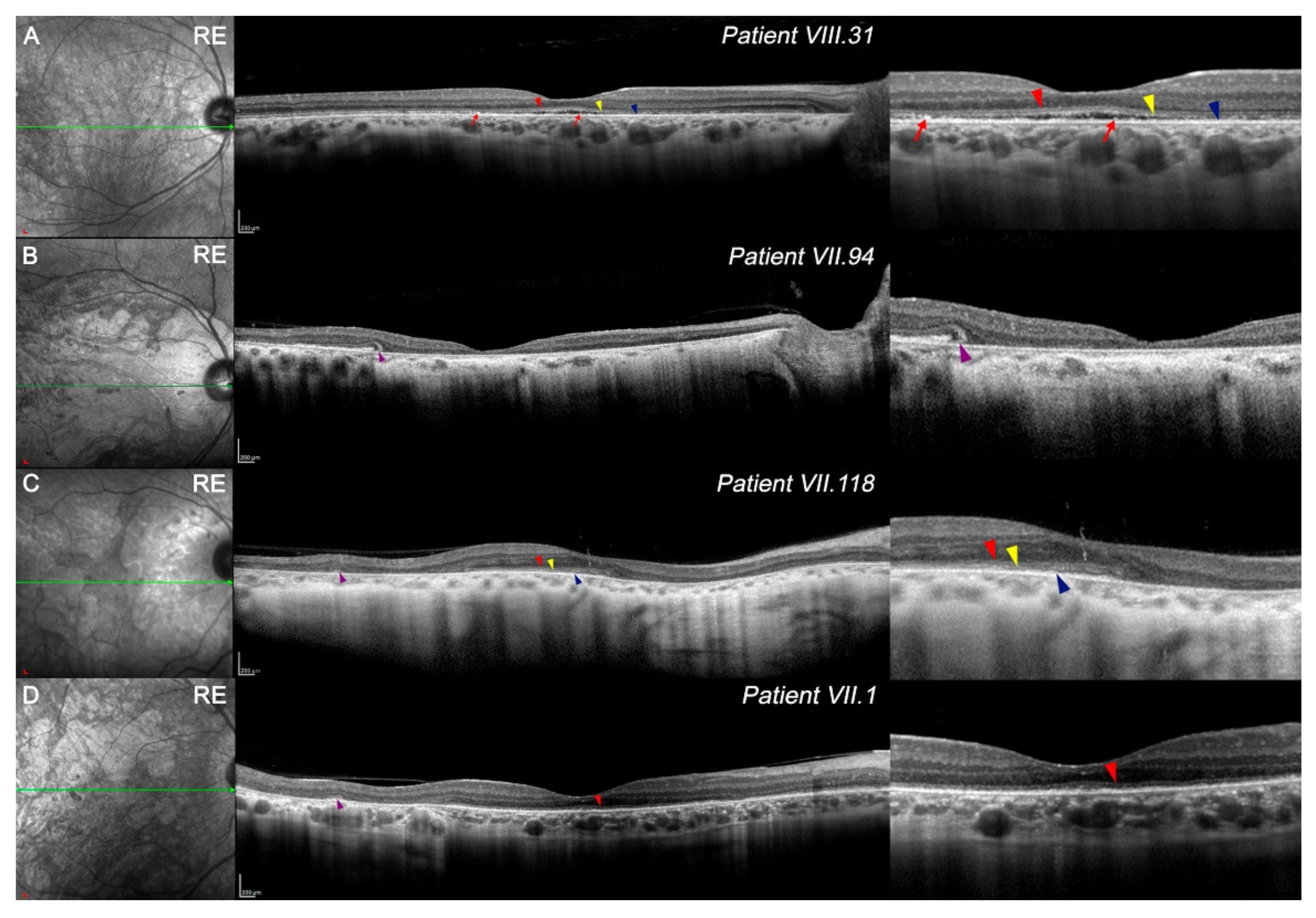 Diagnostics 11 00777 g002 Diagnostics 11 00777 g002