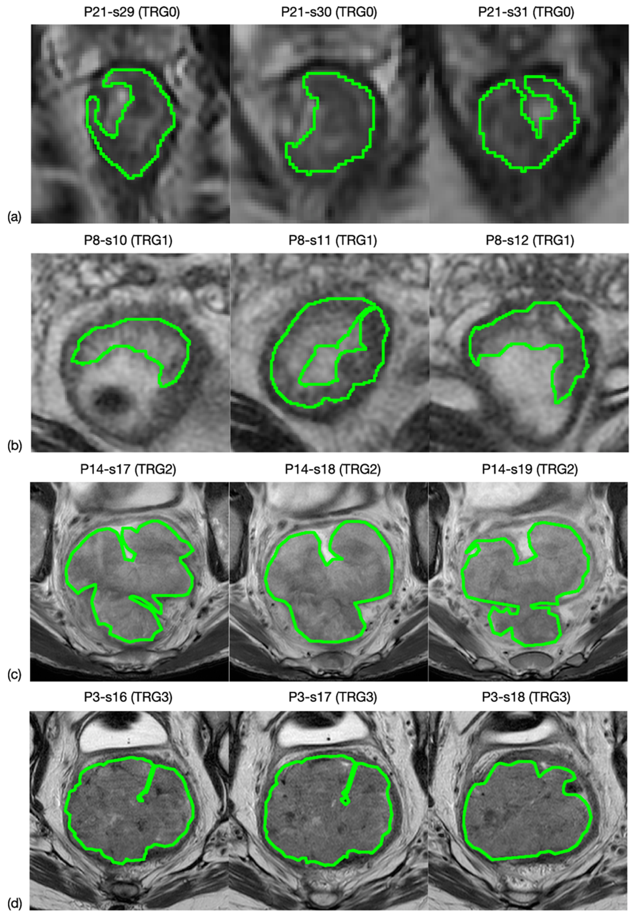 Diagnostics 11 00795 g001 Diagnostics 11 00795 g001