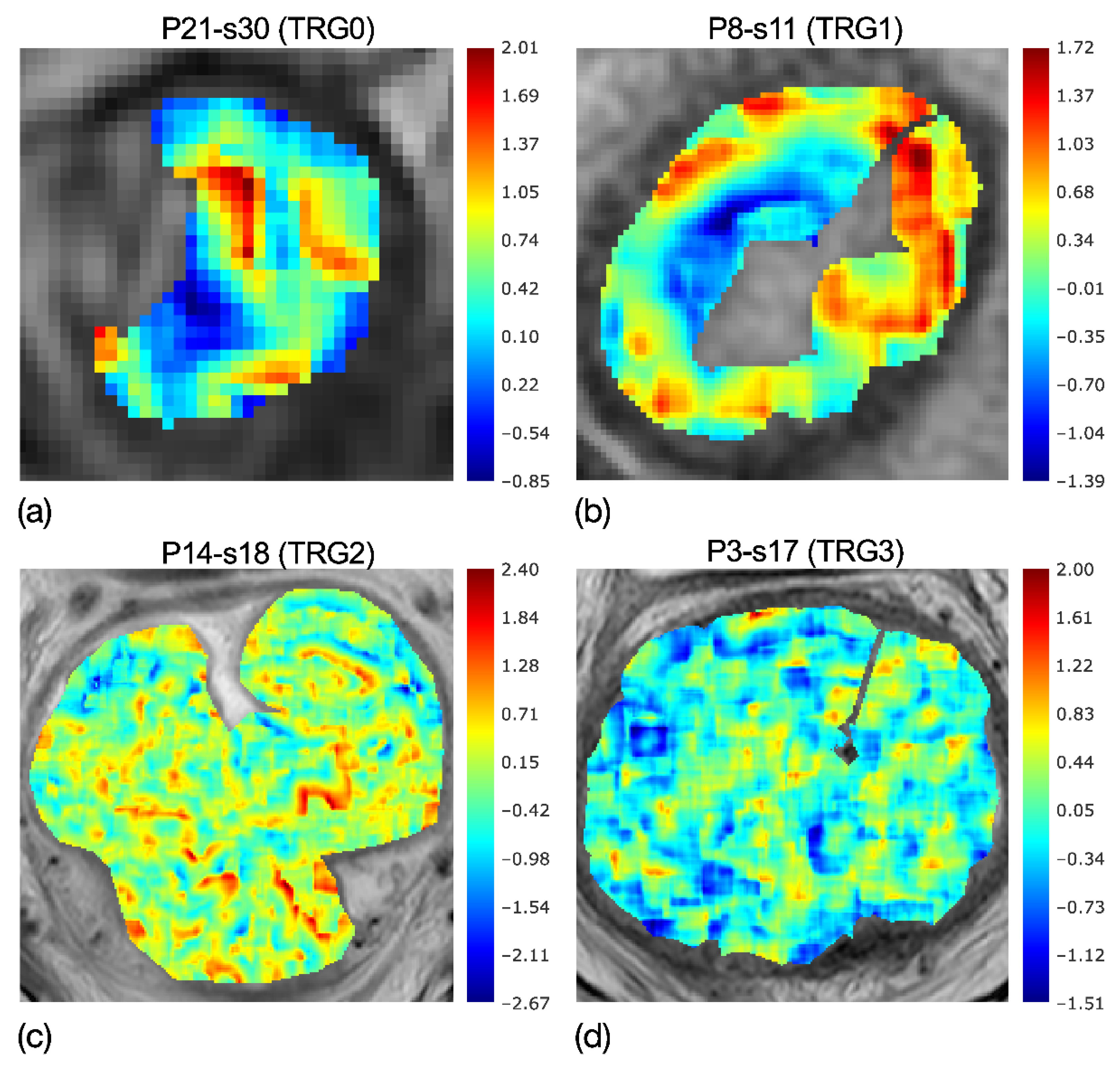 Diagnostics 11 00795 g004 Diagnostics 11 00795 g004