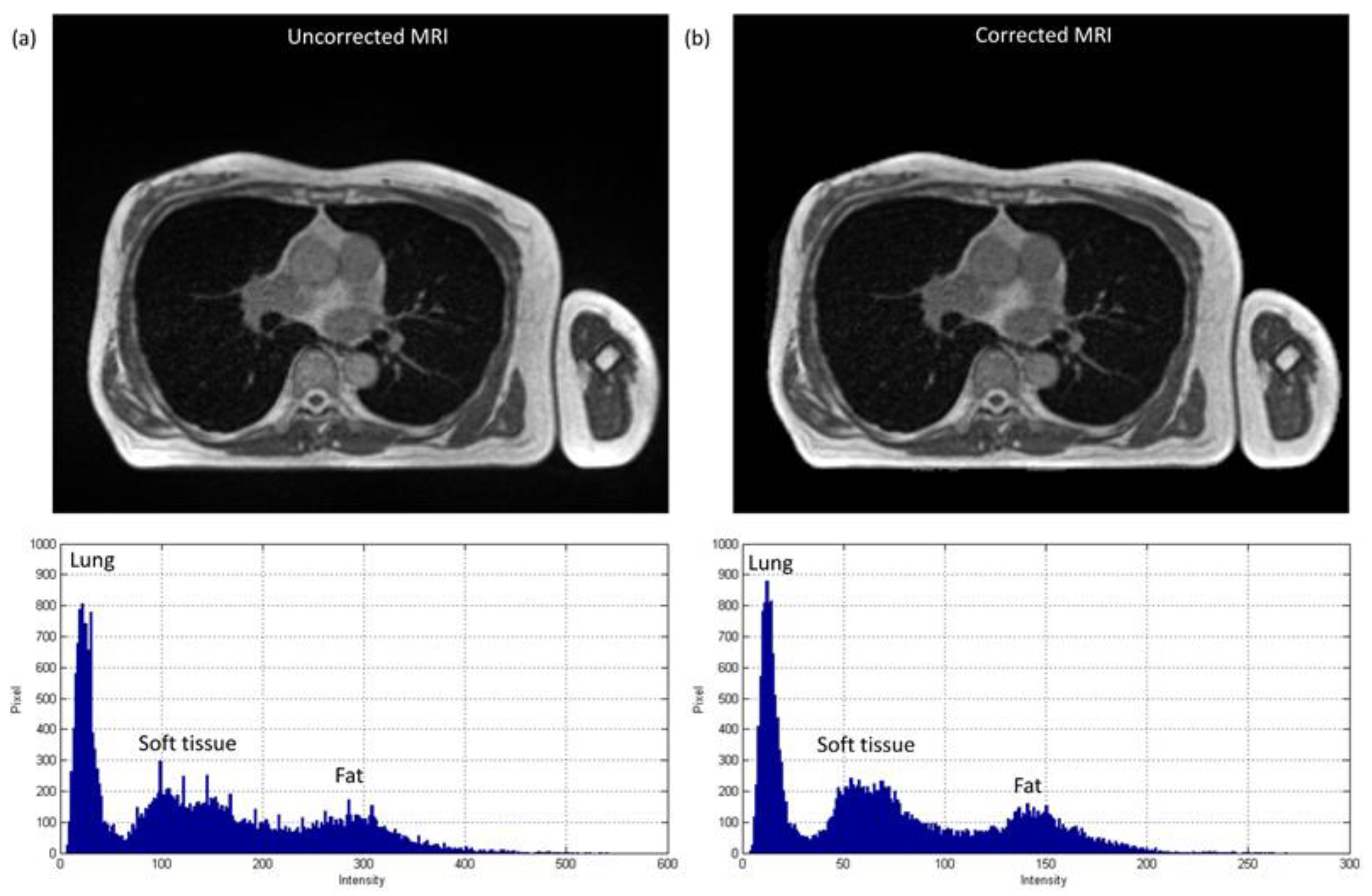 Diagnostics 11 00816 g005