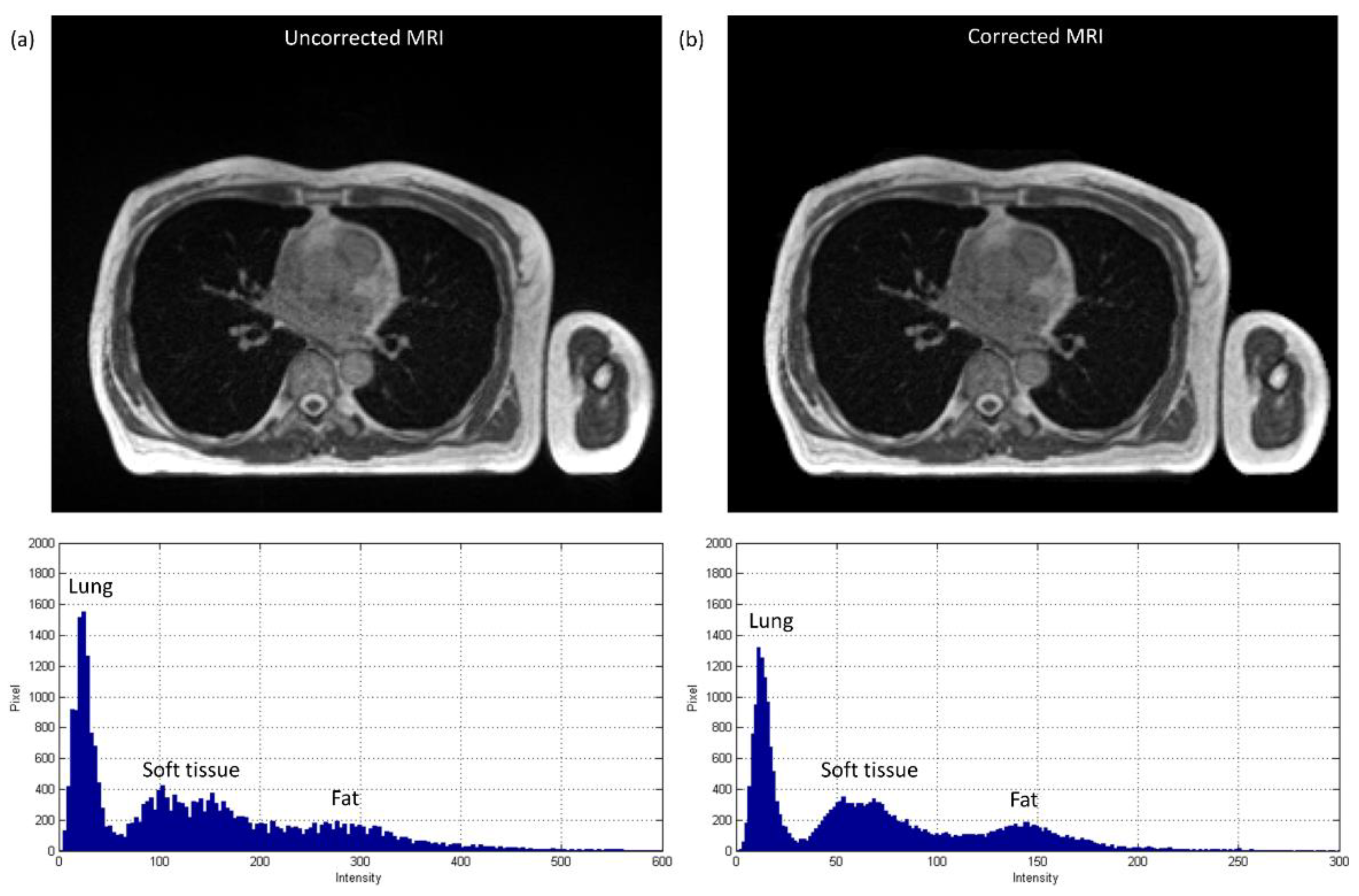 Diagnostics 11 00816 g006