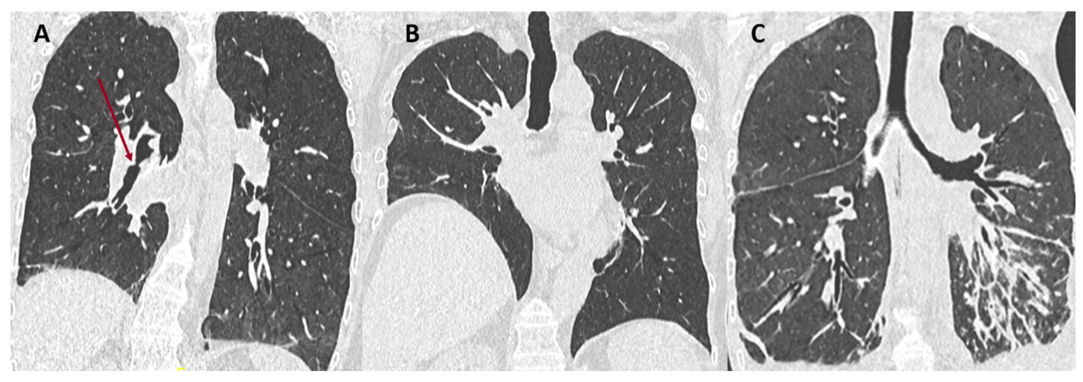 Diagnostics 11 00817 g001