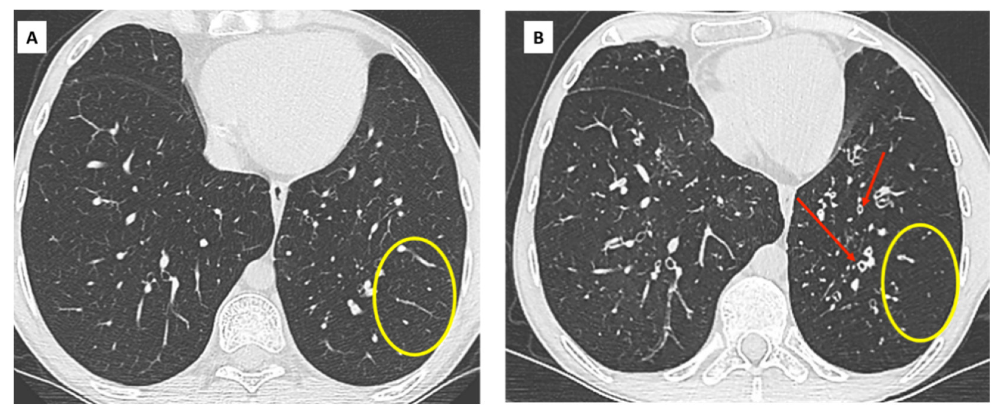 Diagnostics 11 00817 g002