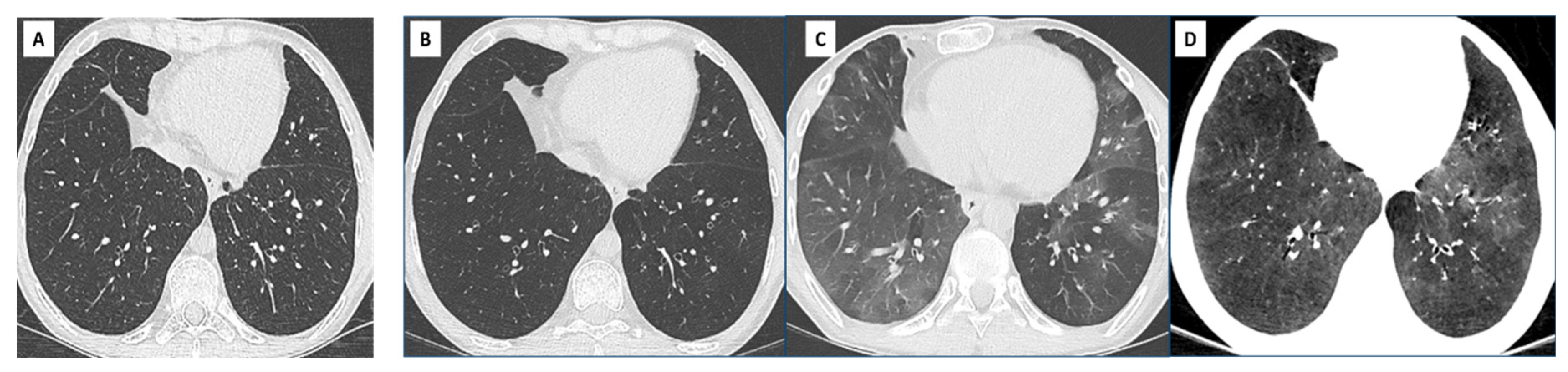 Diagnostics 11 00817 g003