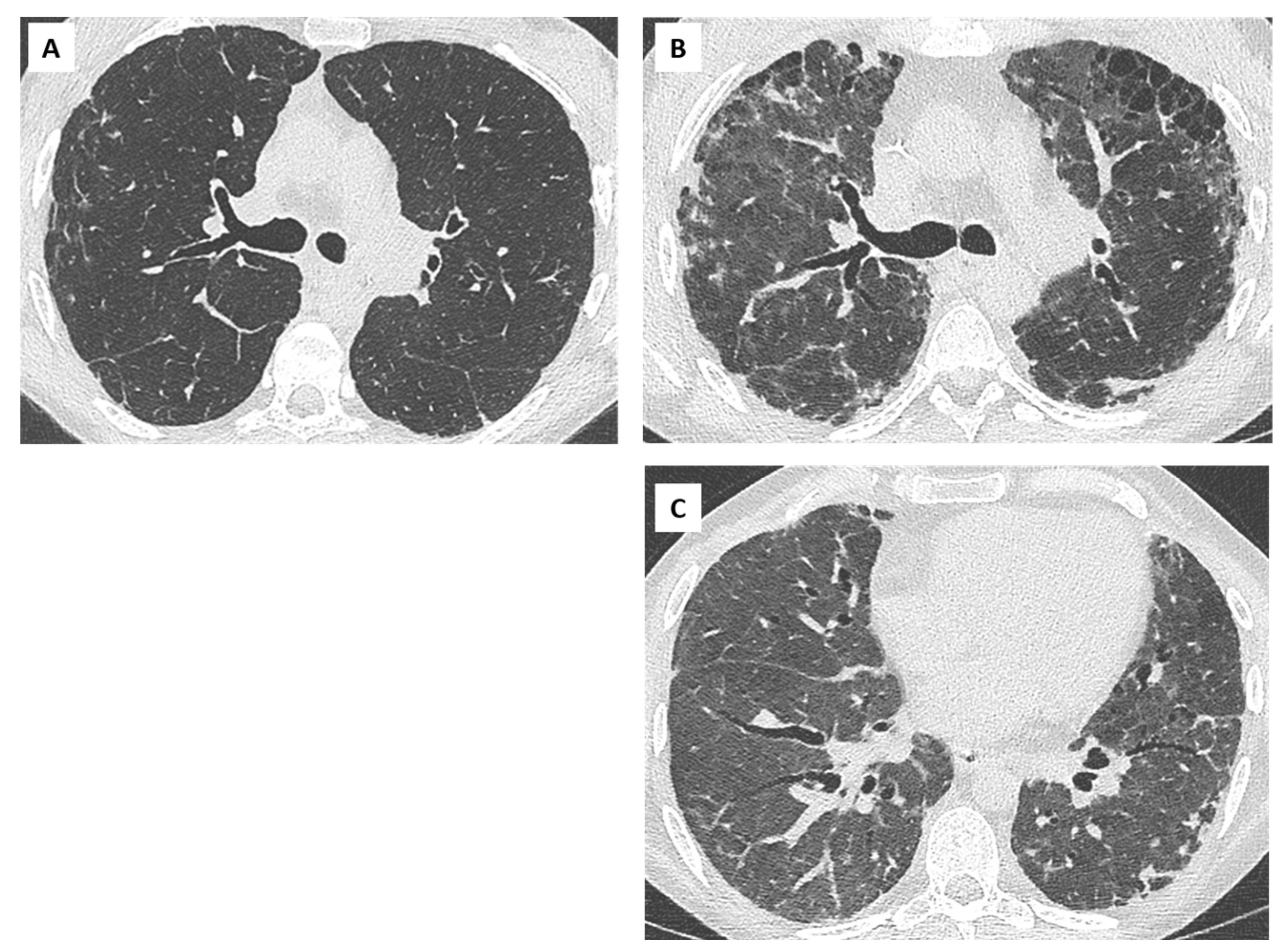 Diagnostics 11 00817 g004