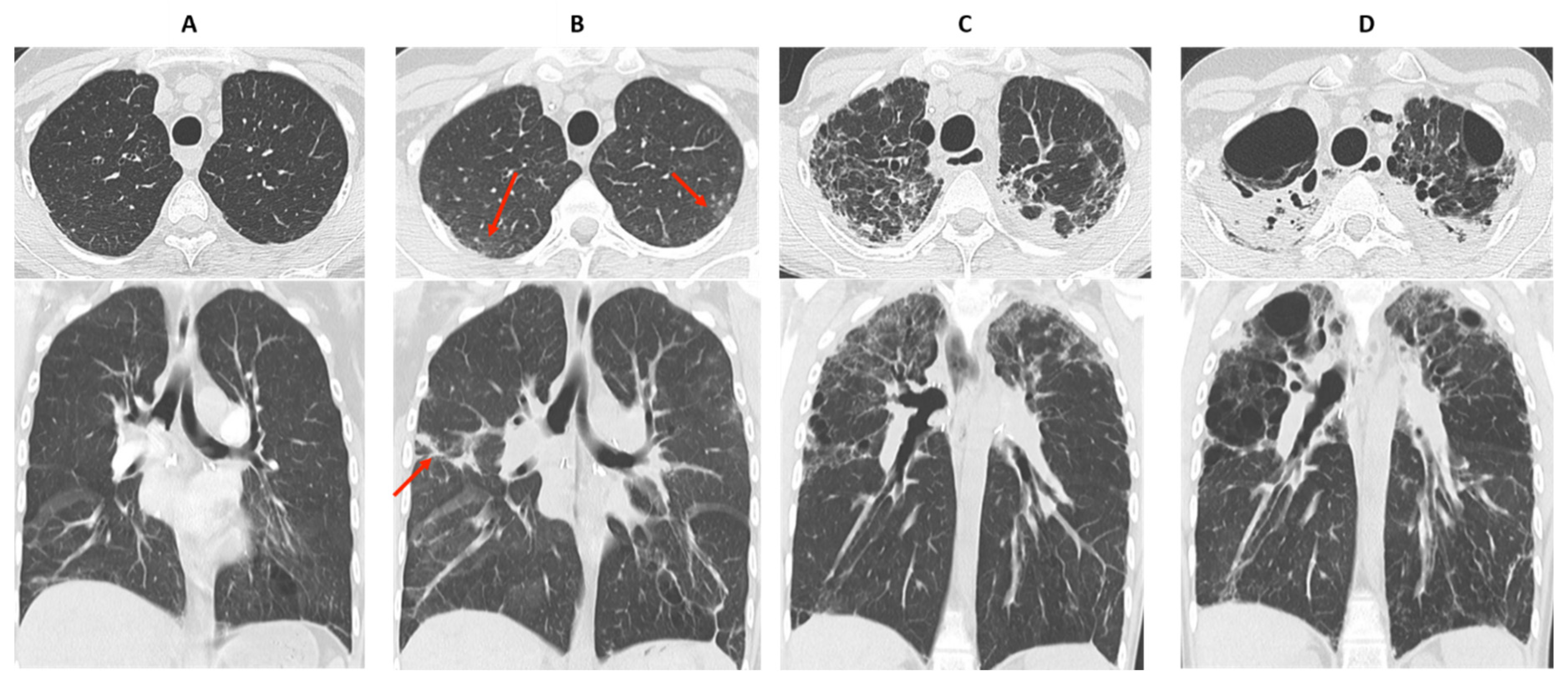 Diagnostics 11 00817 g005