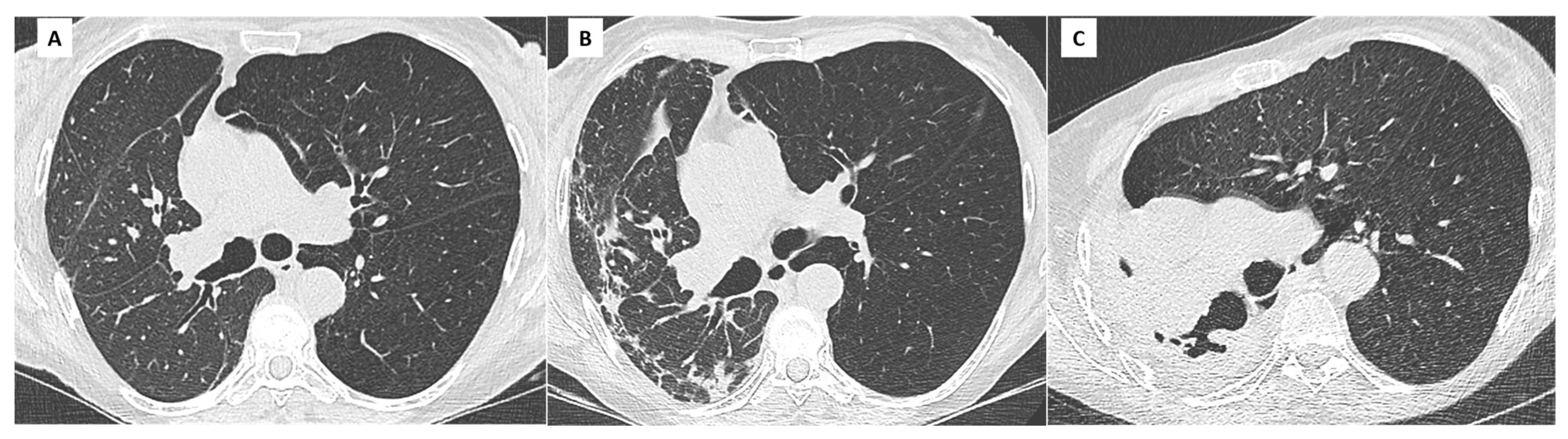 Diagnostics 11 00817 g006