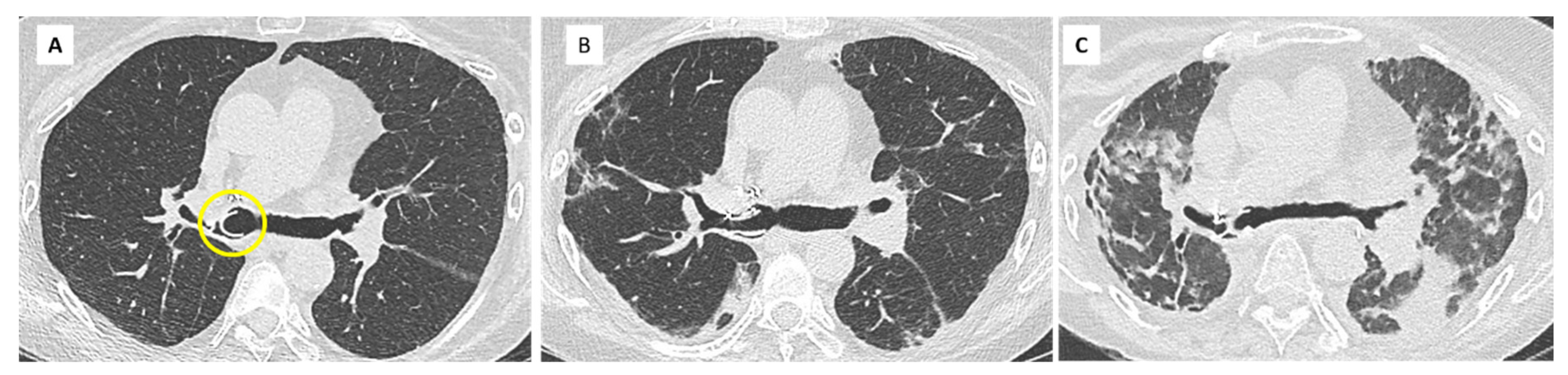 Diagnostics 11 00817 g007